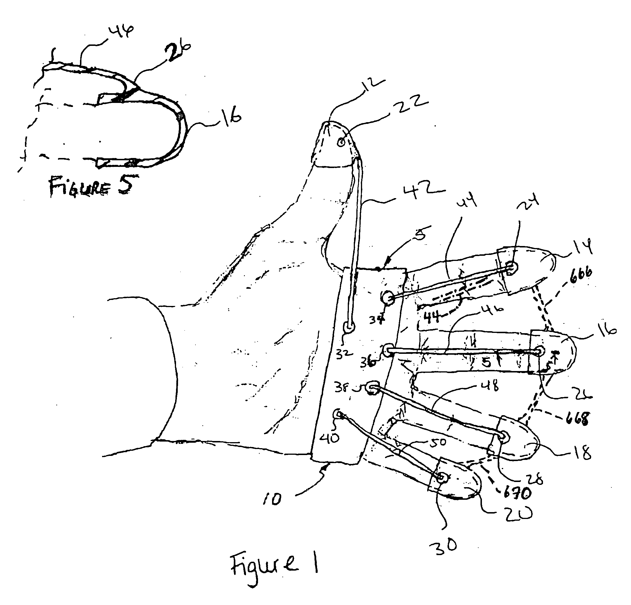 Hand exercising device