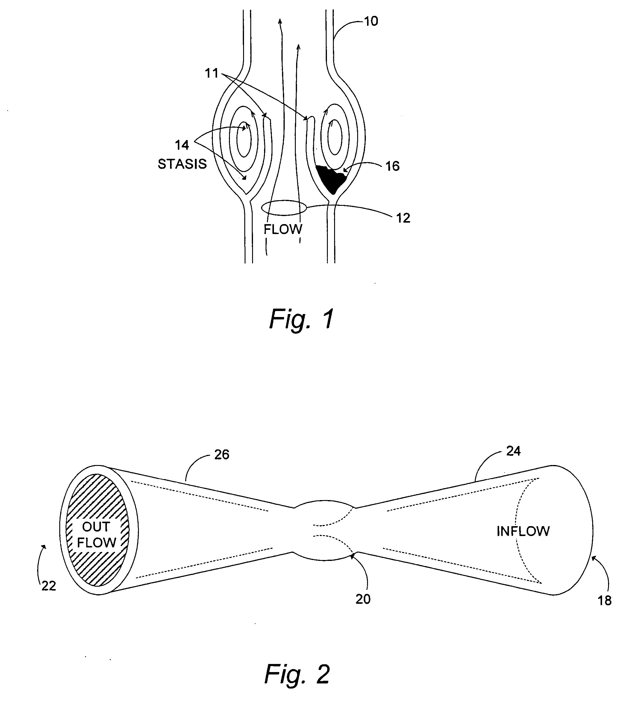 Venous valve prosthesis and method of fabrication