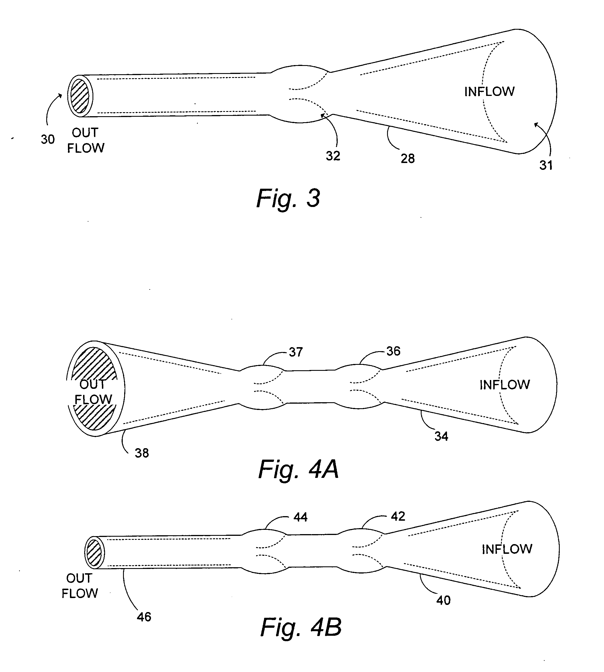 Venous valve prosthesis and method of fabrication