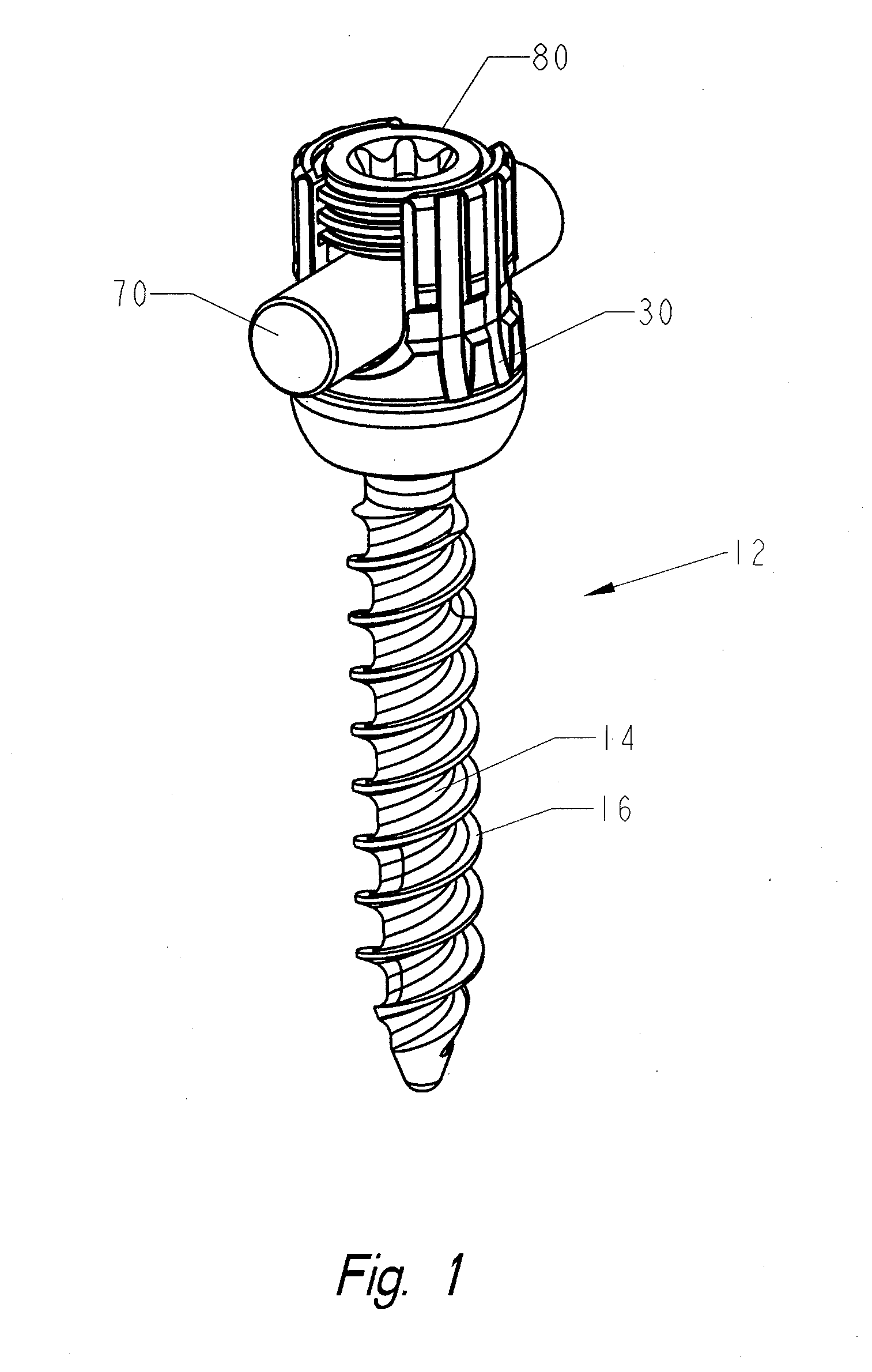 Locking polyaxial ball and socket fastener