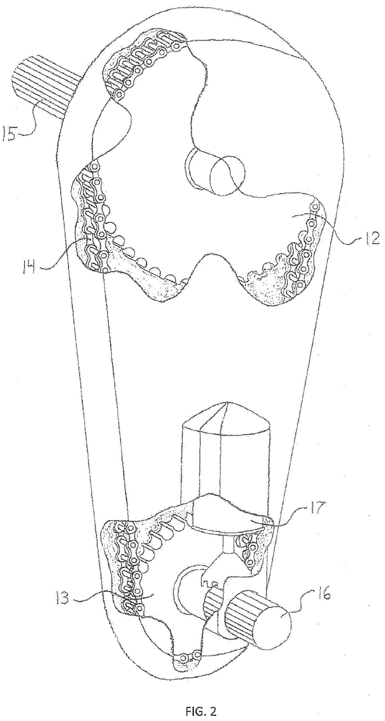 Augmented Rack And Pinion Steering System