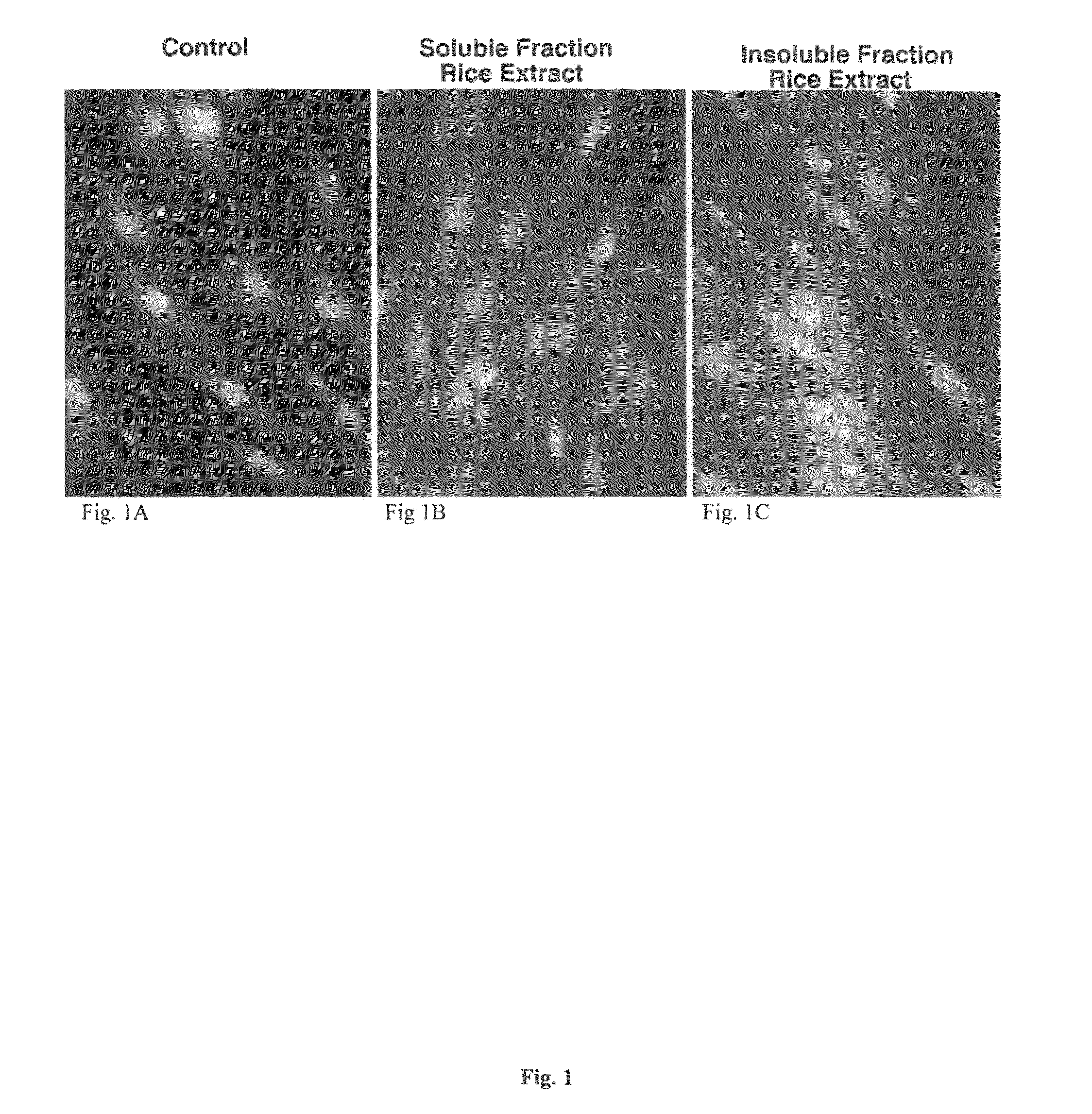 Plant-derived elastin binding protein ligands and methods of using the same