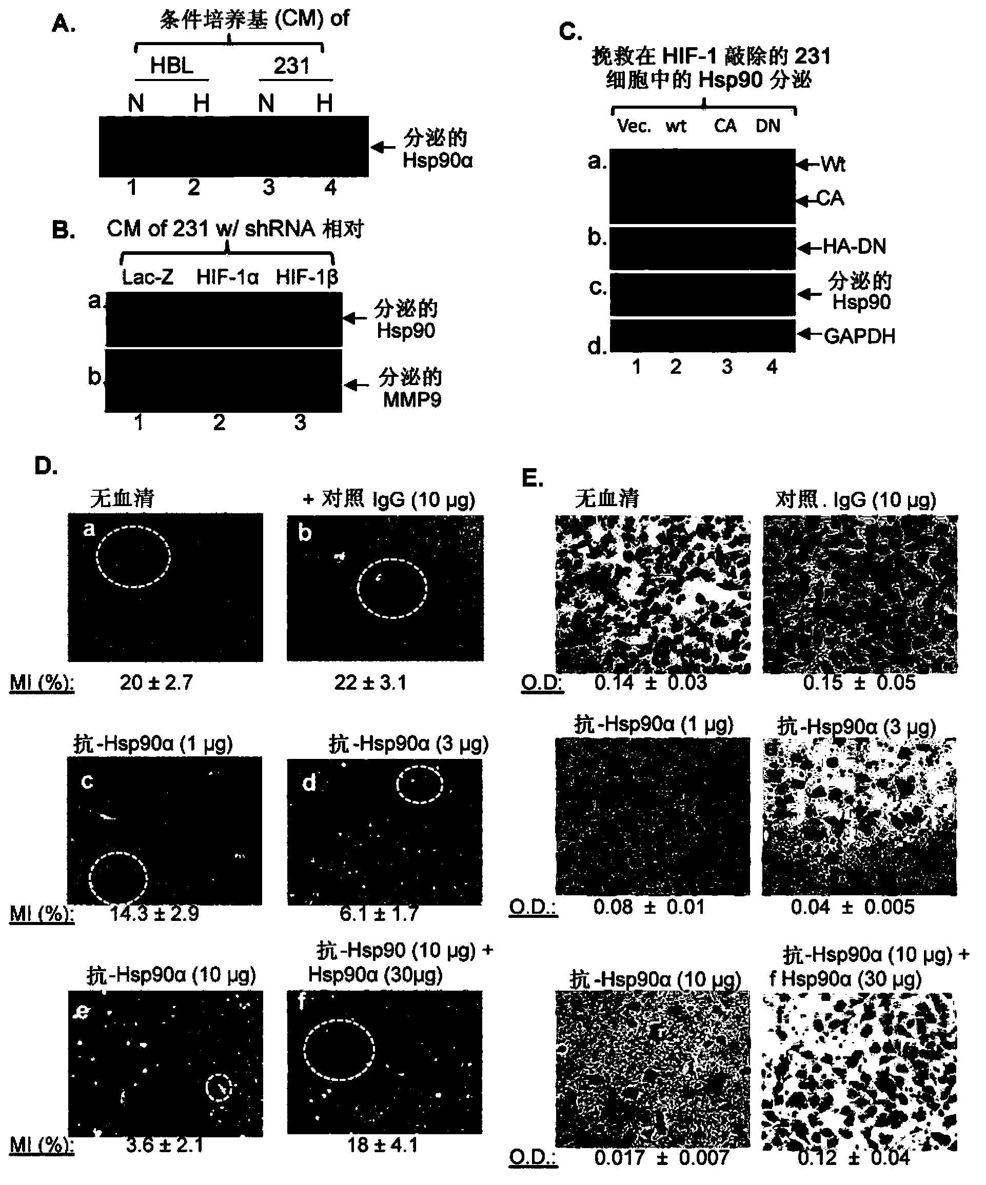 Fragment of secreted heat shock protein-90alpha (Hsp90alpha) as vaccines or epitope for monoclonal antibody drugs or target for small molecule drugs against a range of solid human tumors