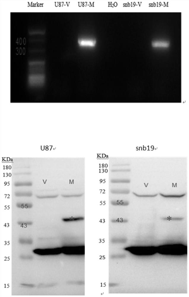 Application of methionine enzyme gene therapy in treatment of malignant tumors