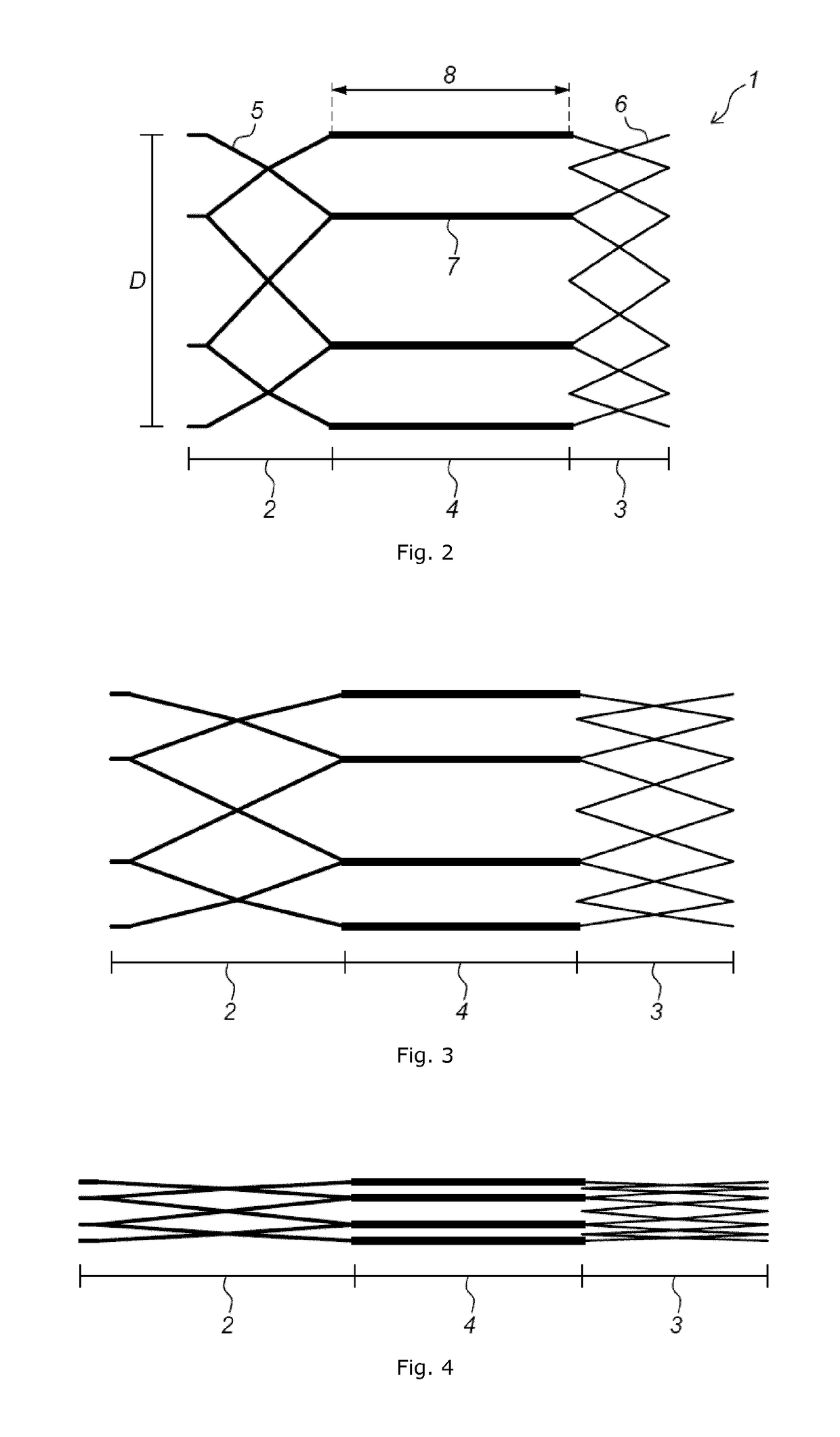 Improved implant device