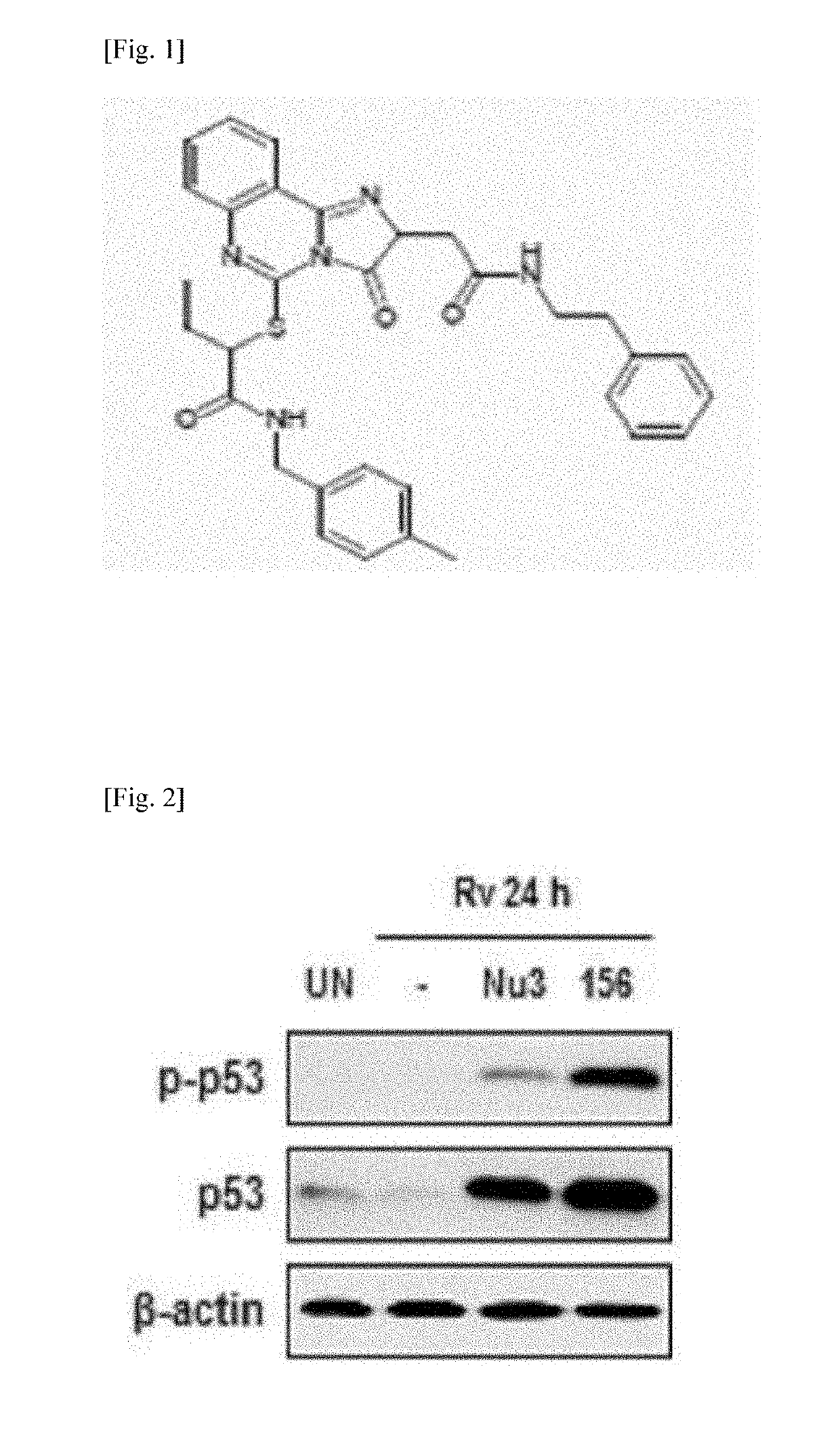 Method for preventing or treating tuberculosis by a p53 expression regulating composition for m. tuberculosis control in cells and the use thereof