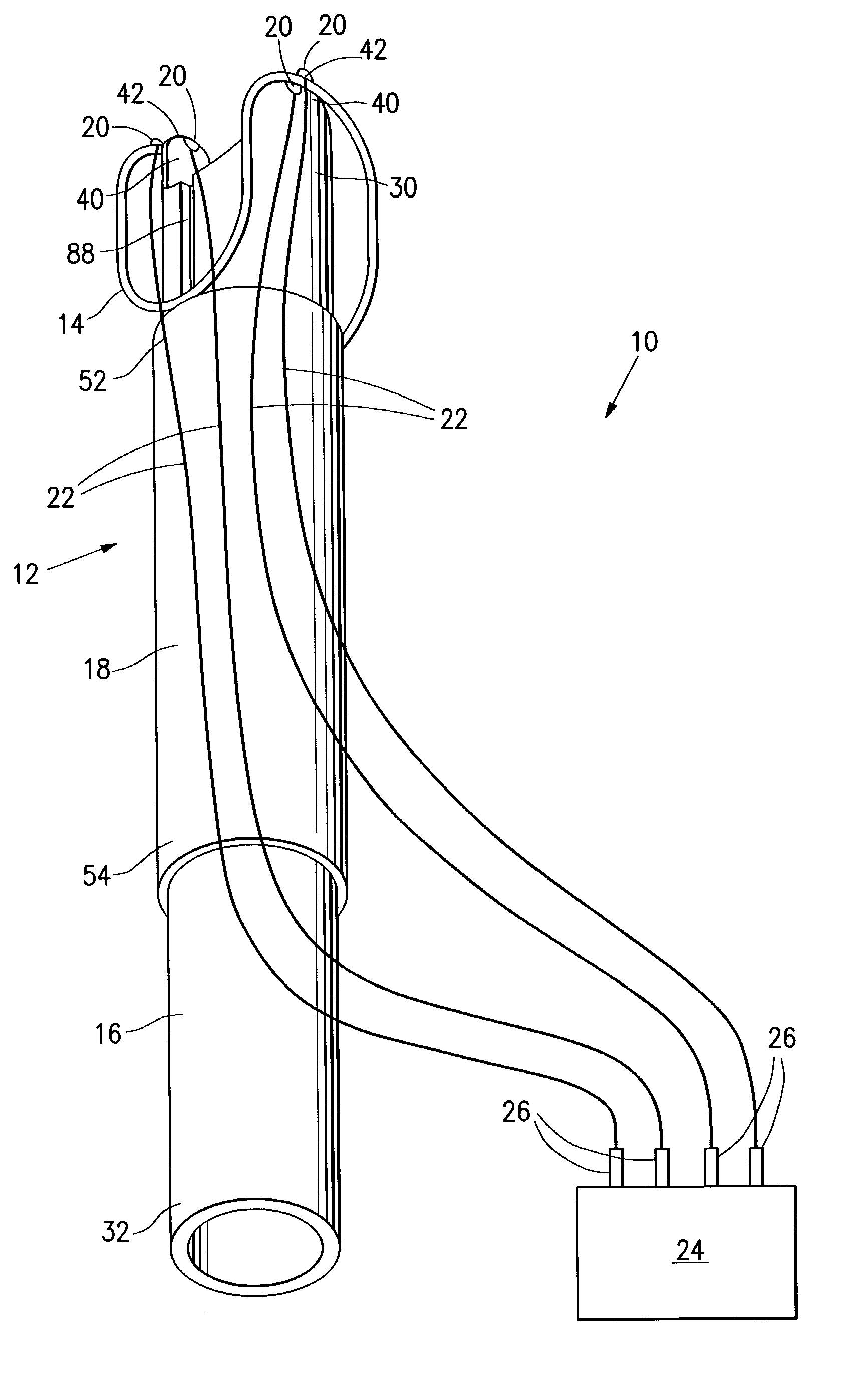 Deployable constrictor for uterine artery occlusion