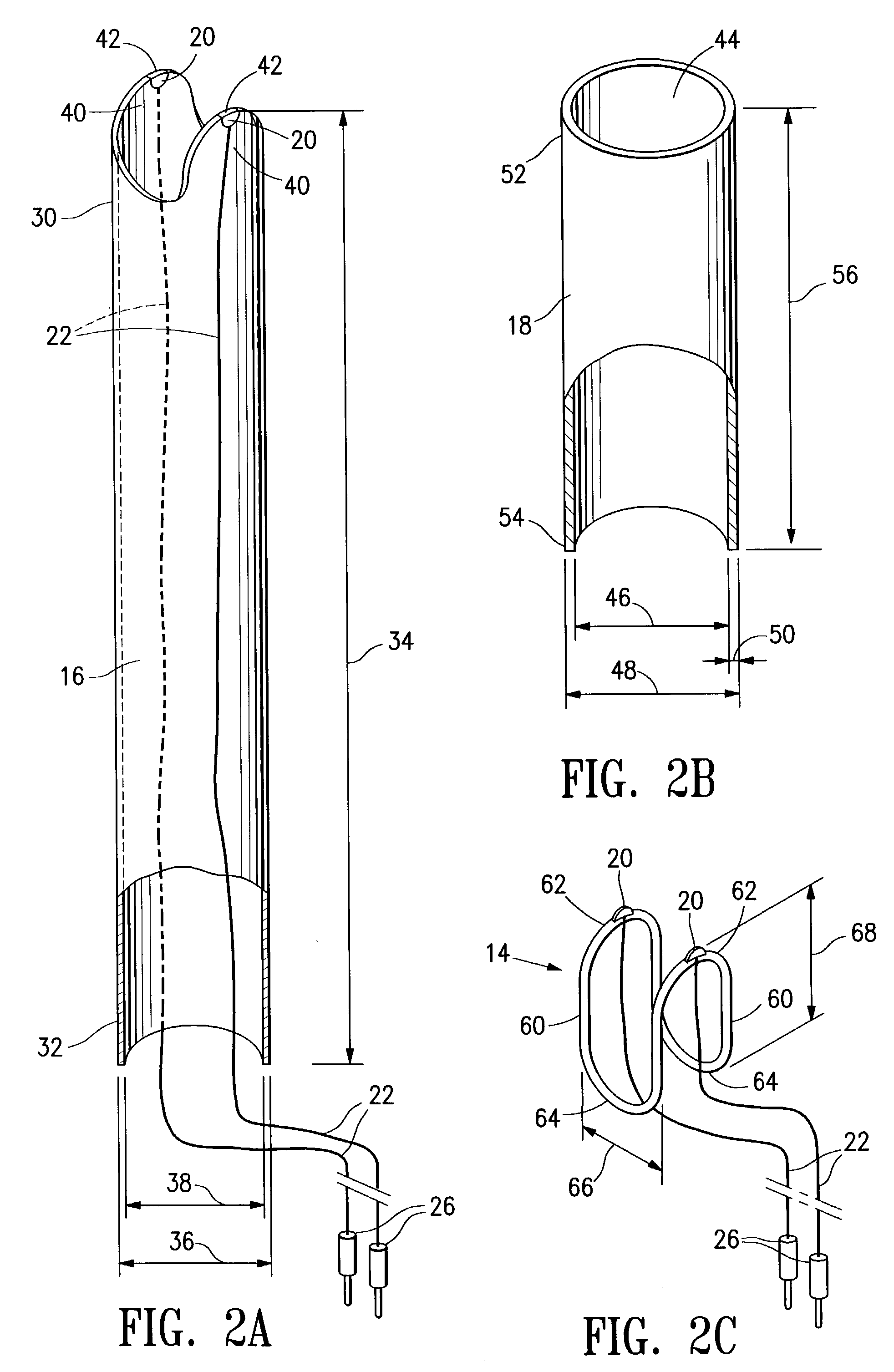 Deployable constrictor for uterine artery occlusion