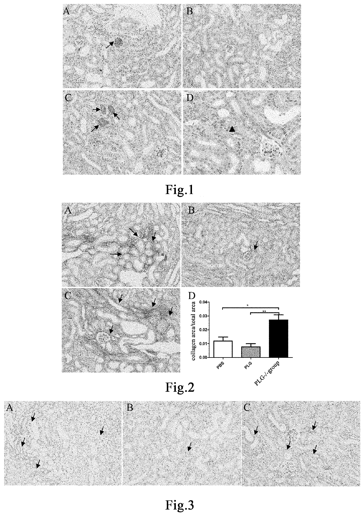Method for preventing and treating pathological renal tissue injury