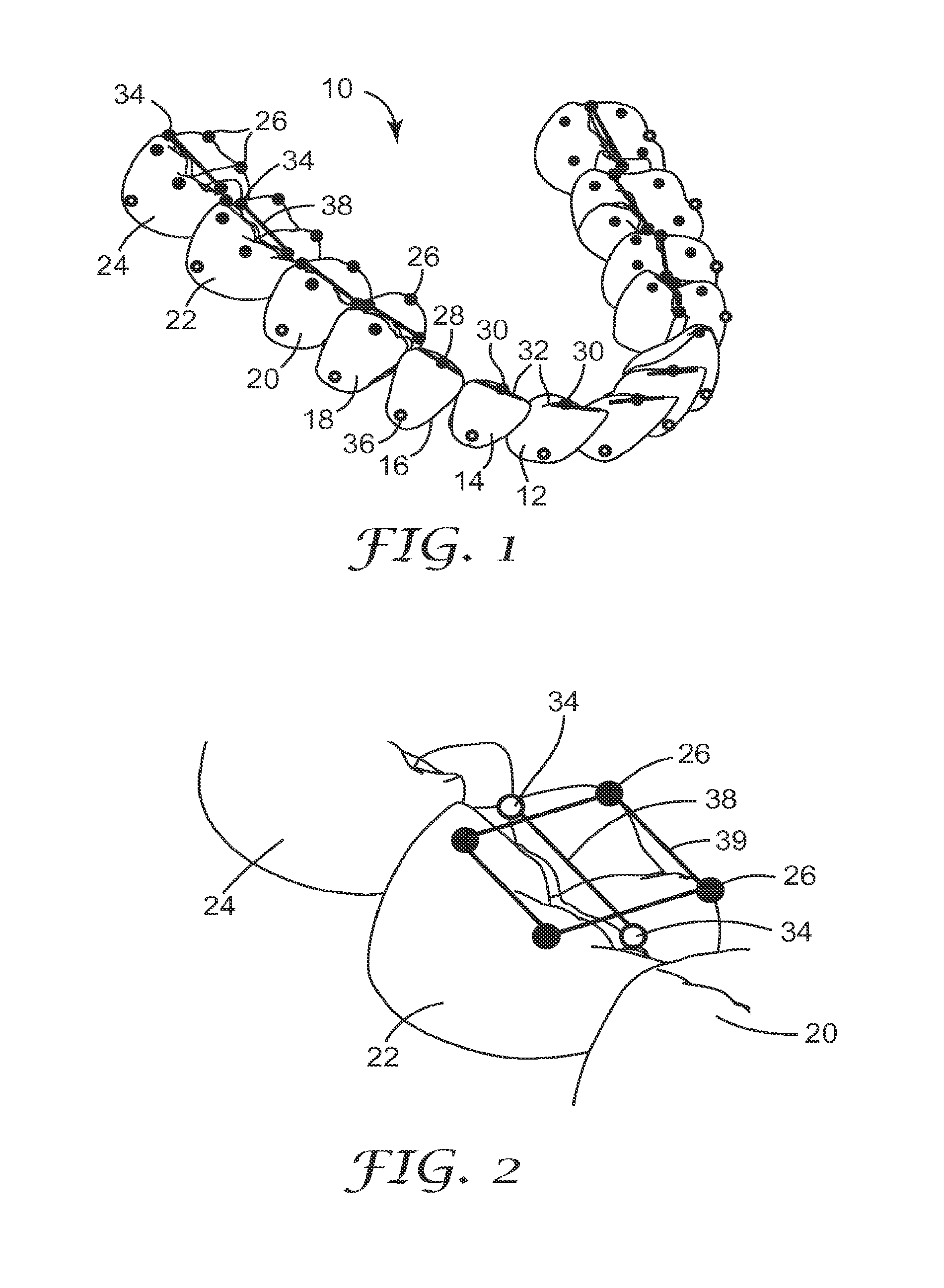 Methods and systems for determining the positions of orthodontic appliances