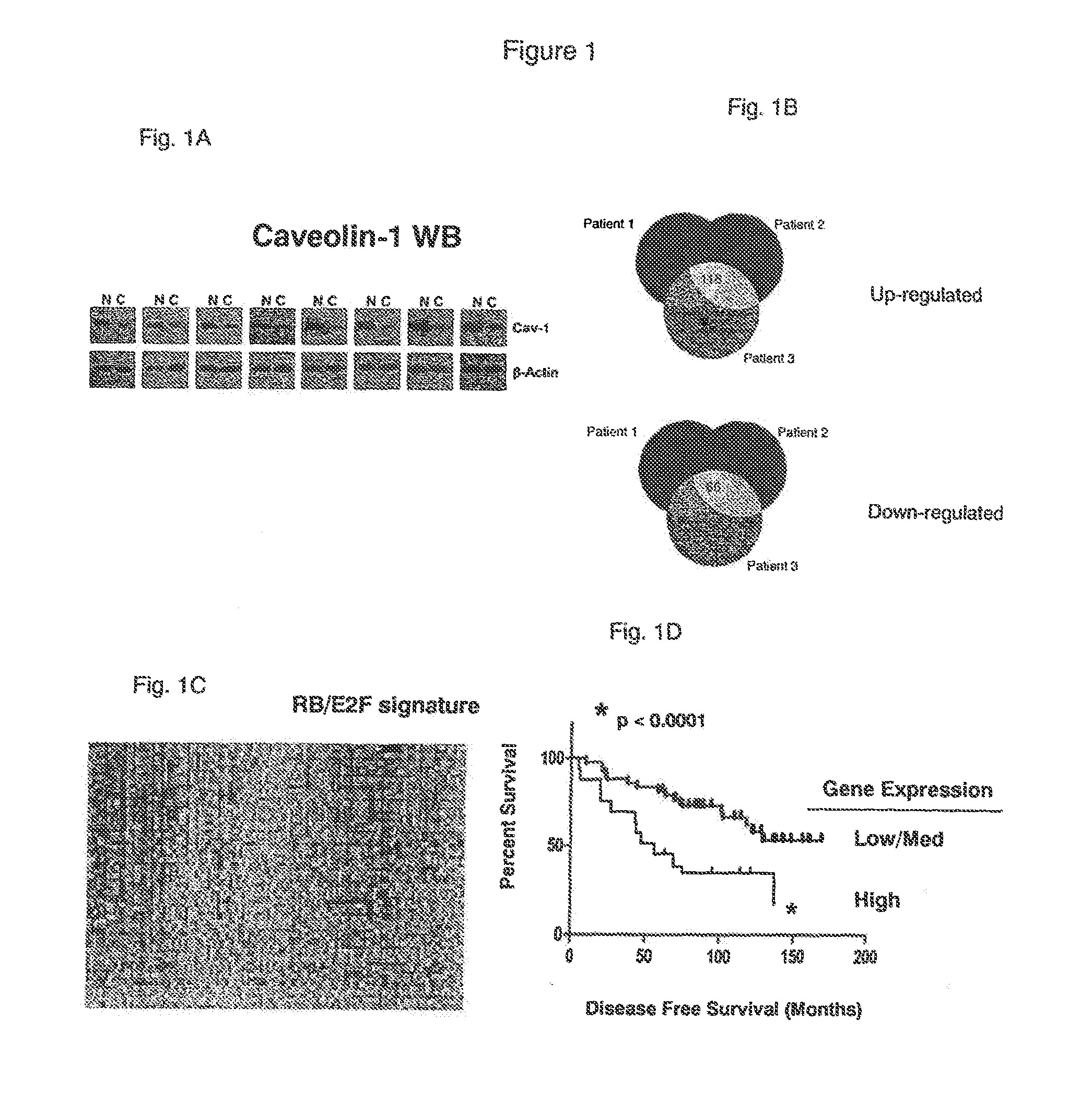 Therapeutics And Methods For Treating Neoplastic Diseases Comprising Determining The Level Of Caveolin-1 And/Or Caveolin-2 In A Stromal Cell Sample