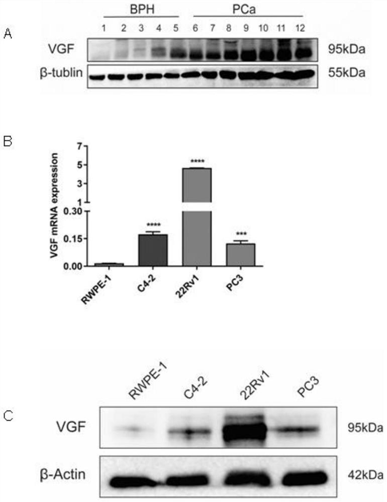 Application of VGF gene in treatment of metastatic prostate cancer