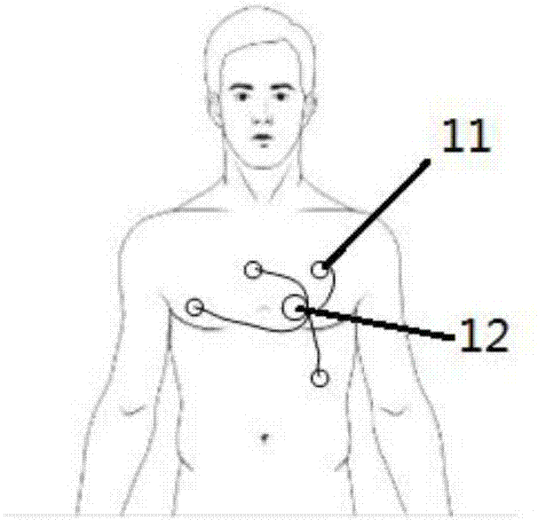 Physiological information detecting device