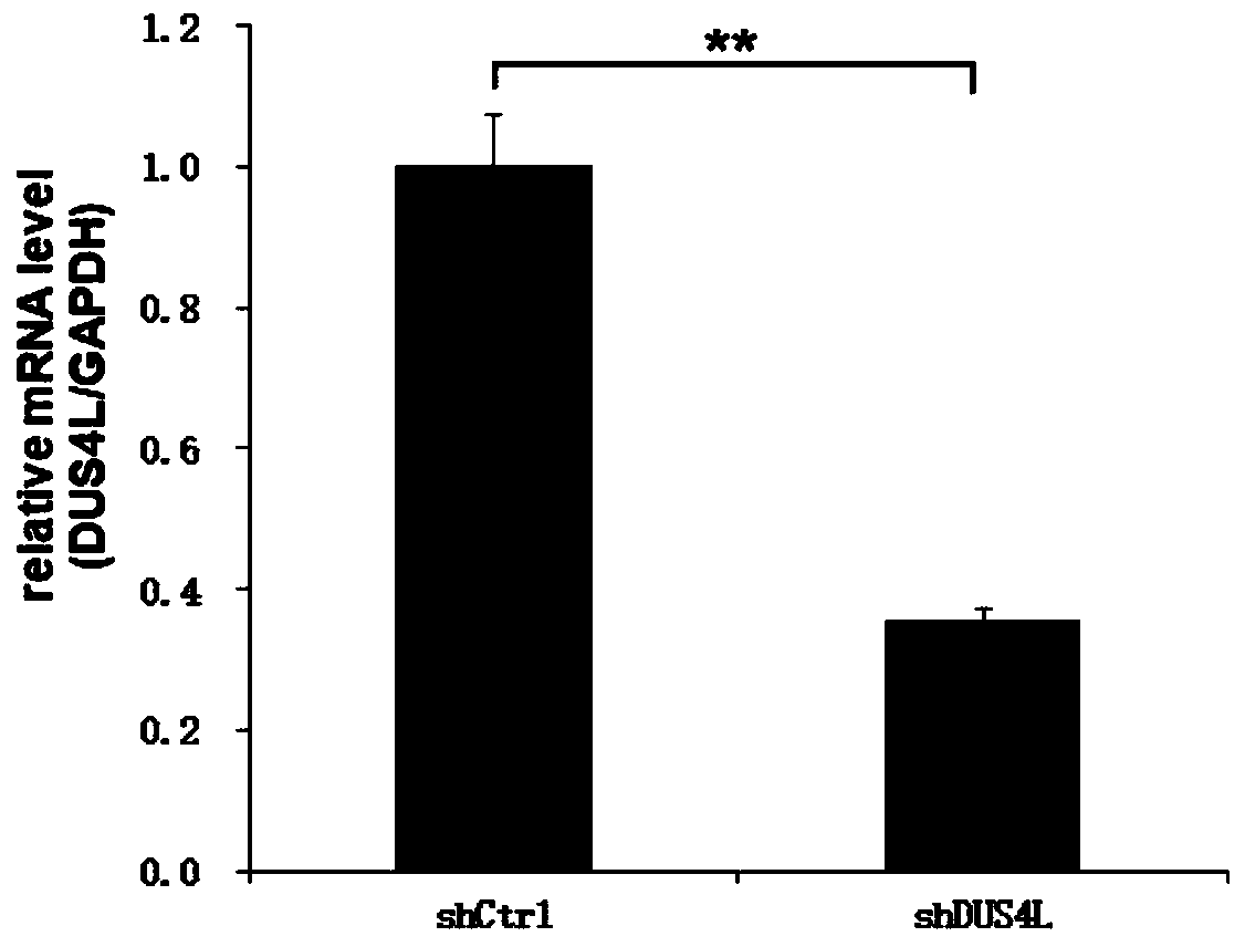 Application of human DUS4L gene and related product of human DUS4L gene