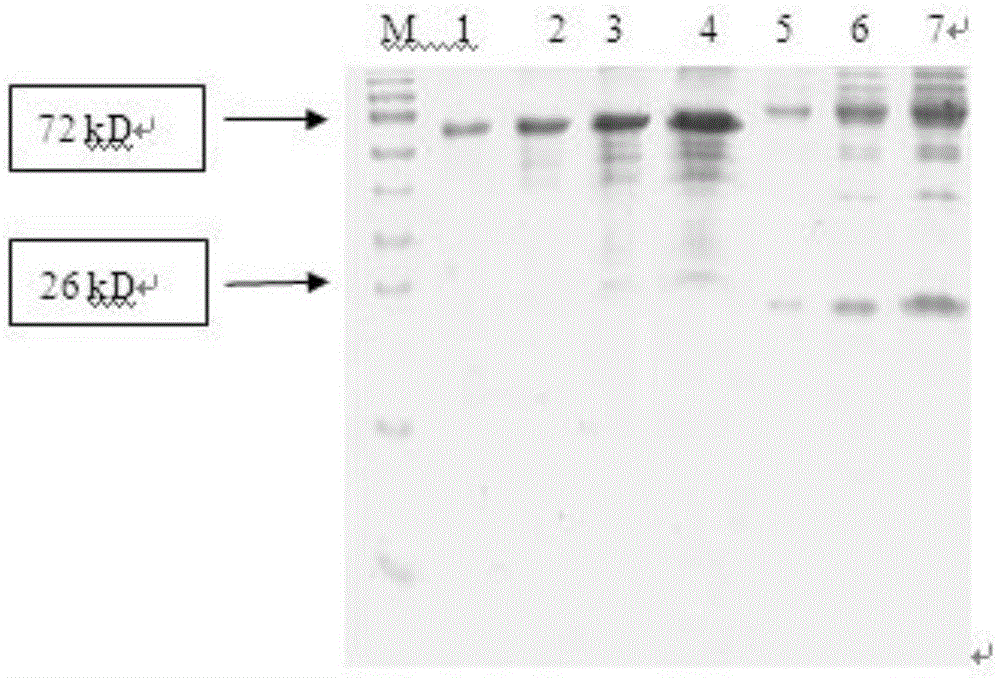 Monoclonal antibody and kit specifically binding to serum type 7 antigen of Actinobacillus pleuropneumoniae