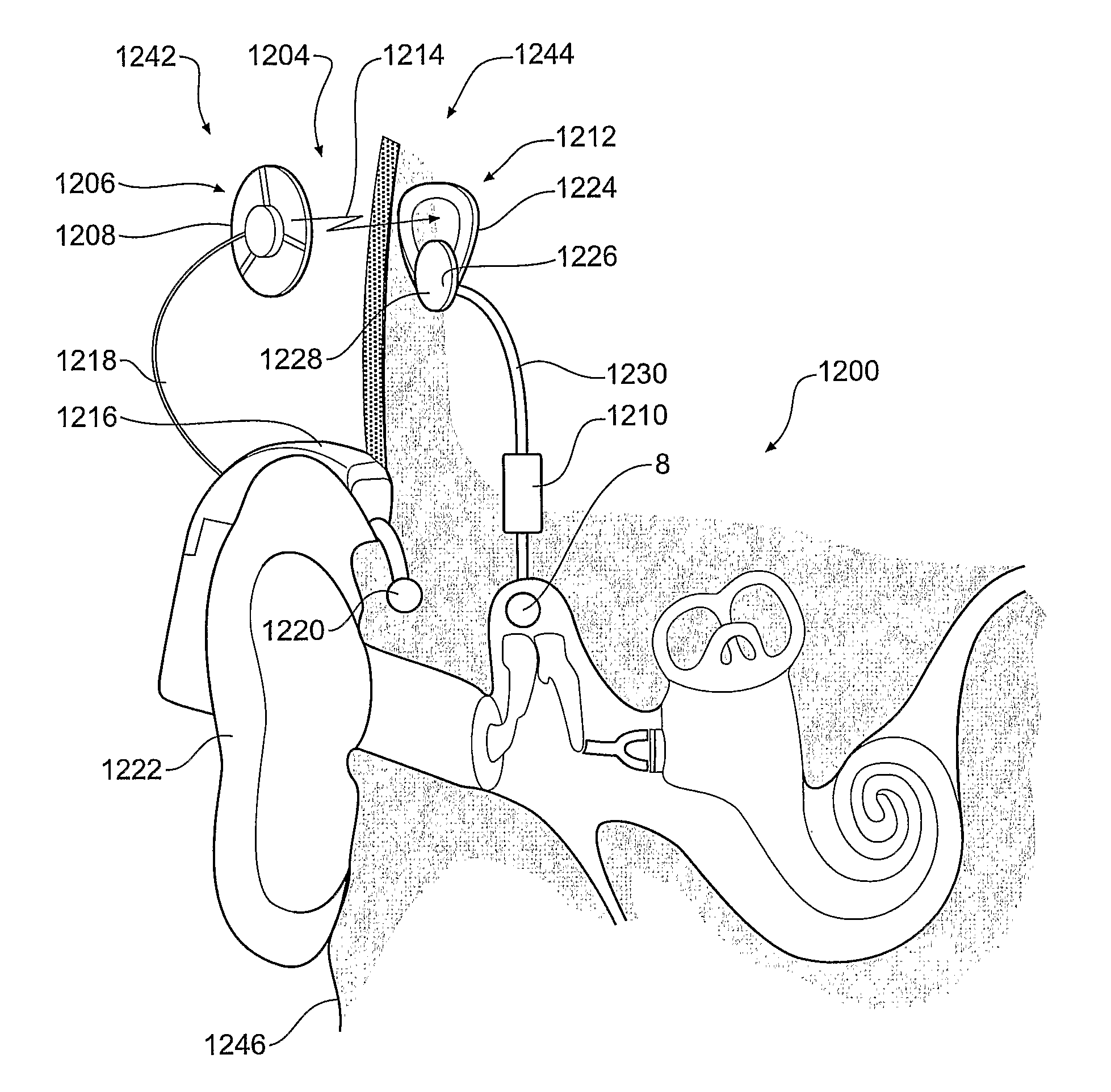 Implantable Actuator For Hearing Aid Applications