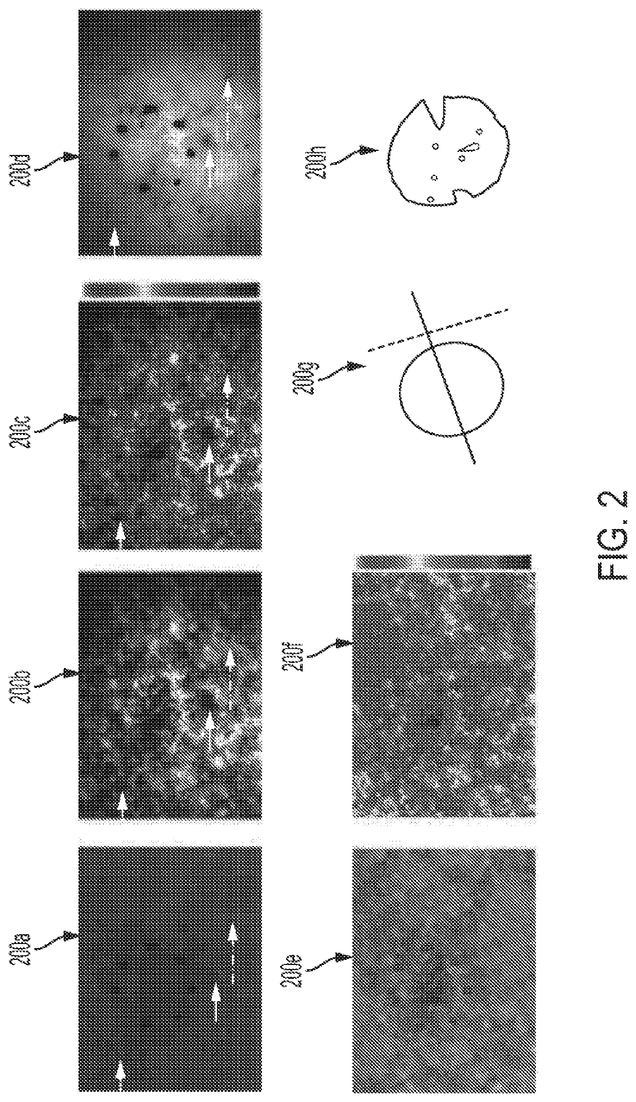 Spectrally encoded optical polarization imaging for detecting skin cancer margins