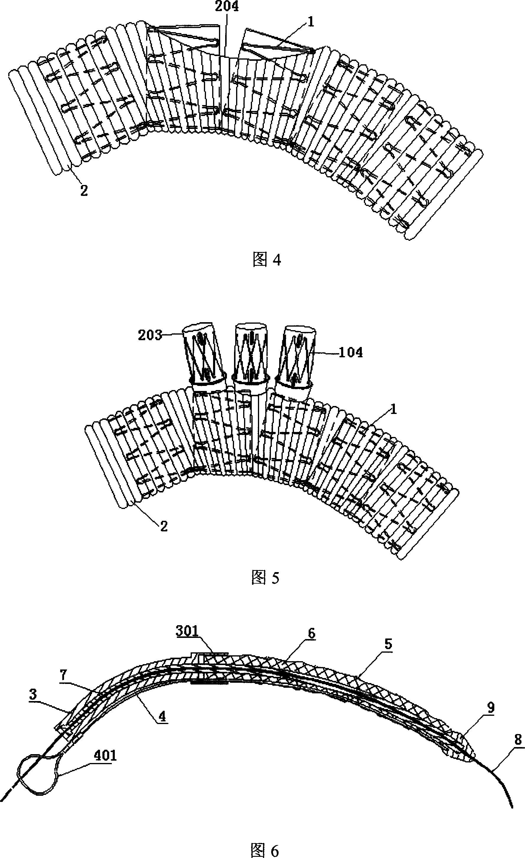 Stent prosthesis used for surgical operation, and delivery device therefor