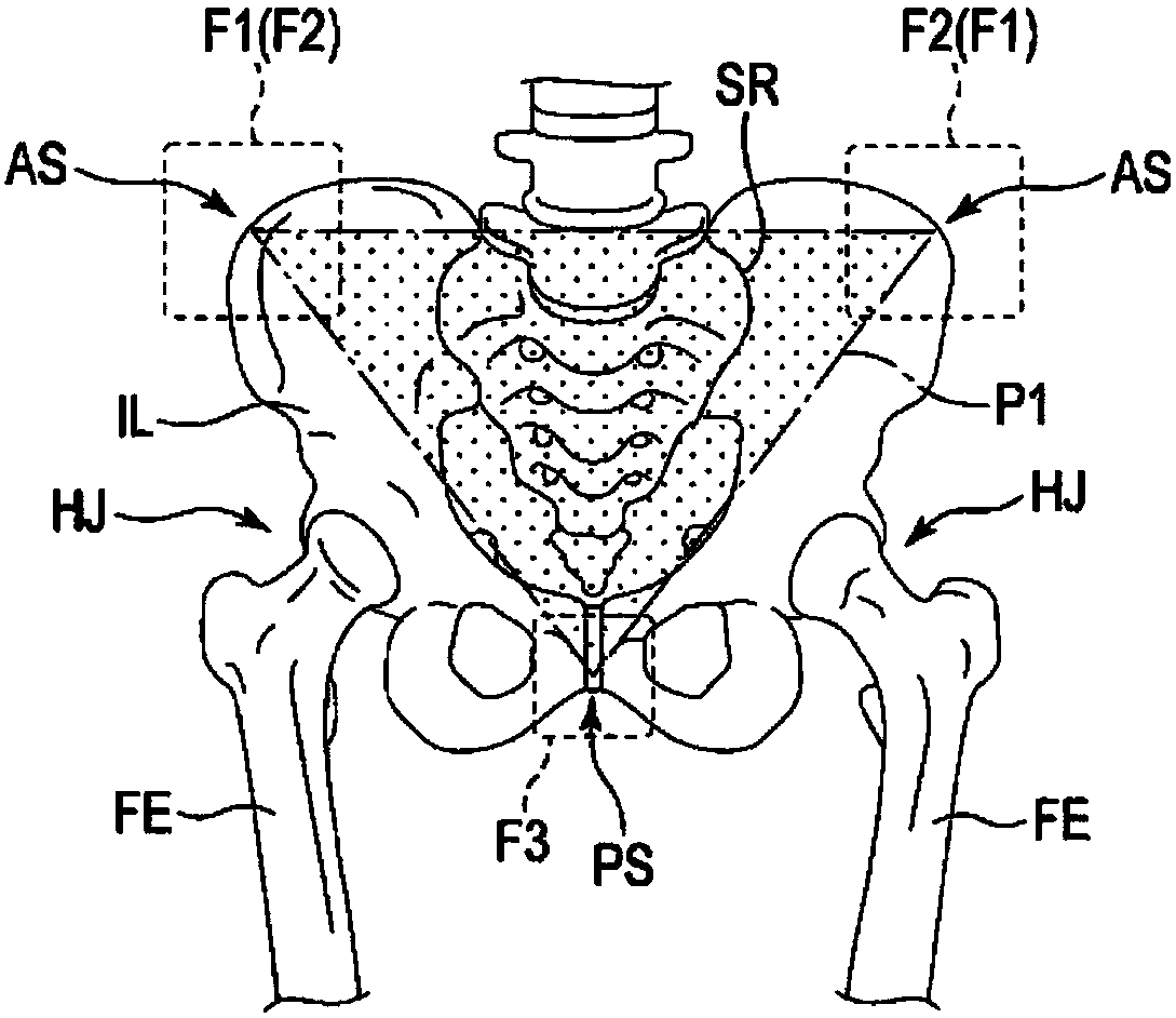 Device for patient body positioning and immobilizing, and angle indicator