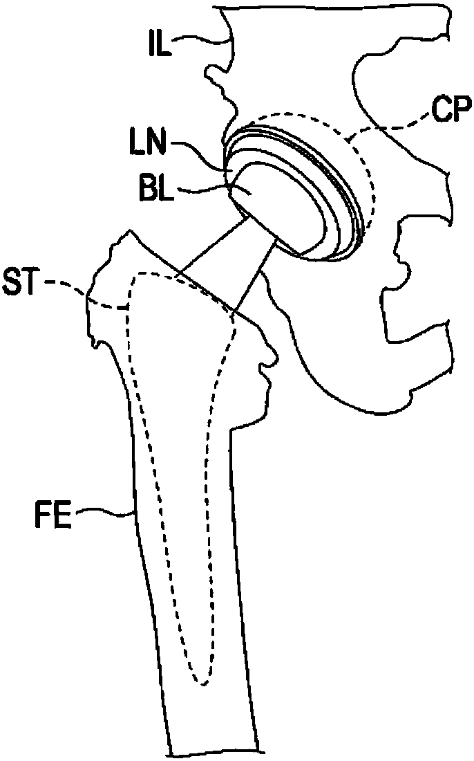 Device for patient body positioning and immobilizing, and angle indicator