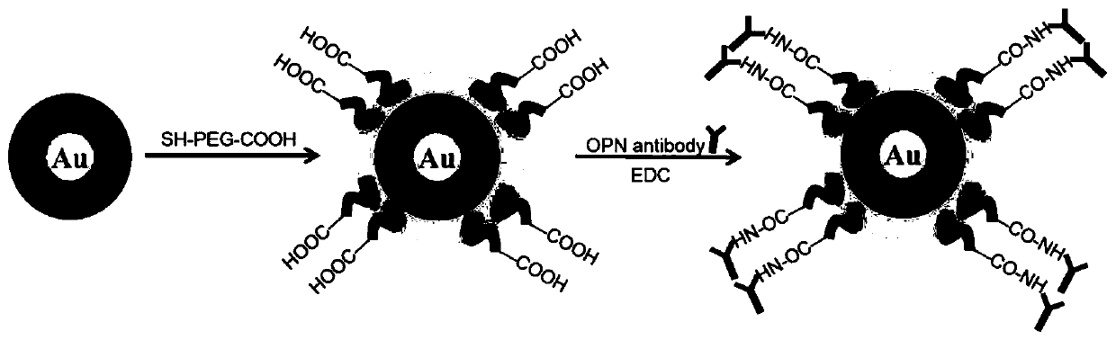 Nanoprobe for CT imaging of Kawasaki disease coronary artery inflammation, and preparation method and application thereof