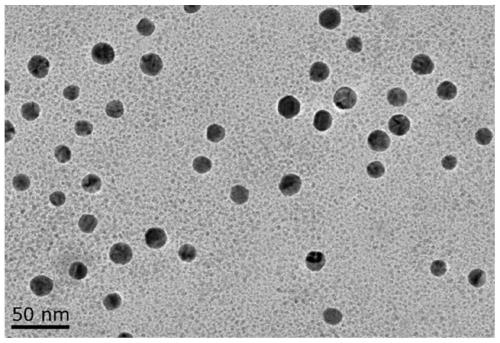 Nanoprobe for CT imaging of Kawasaki disease coronary artery inflammation, and preparation method and application thereof