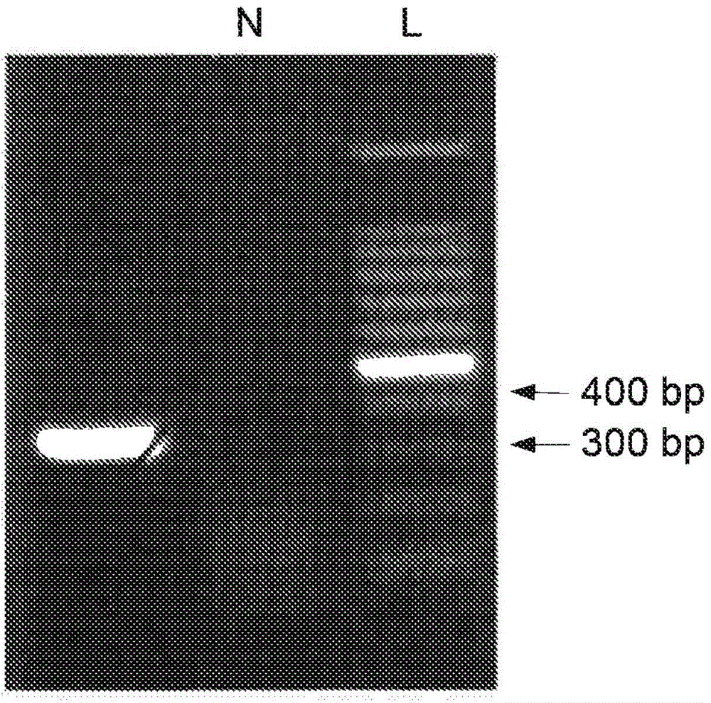 Chimeric momp antigen, method and use