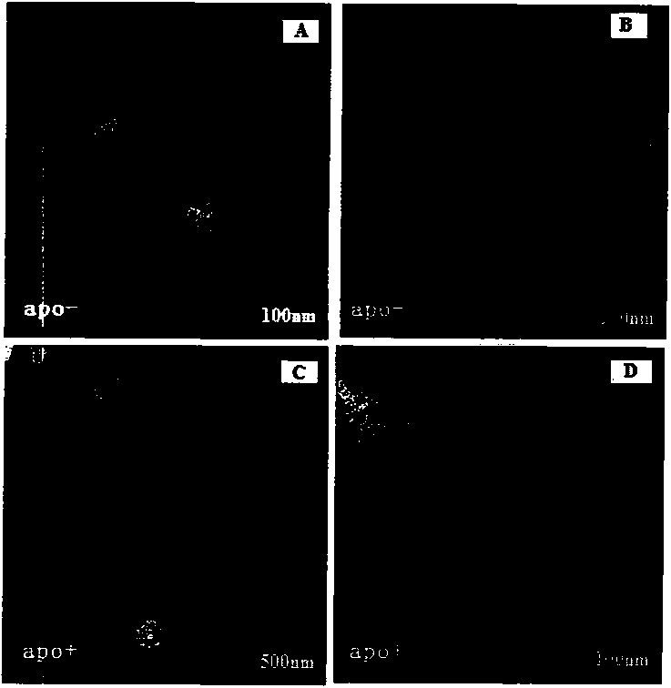 Recombinant high density lipoprotein (HDL) medicament delivery system with functions of targeted and reverse cholesterol transport (RCT) on vascular wall and application thereof