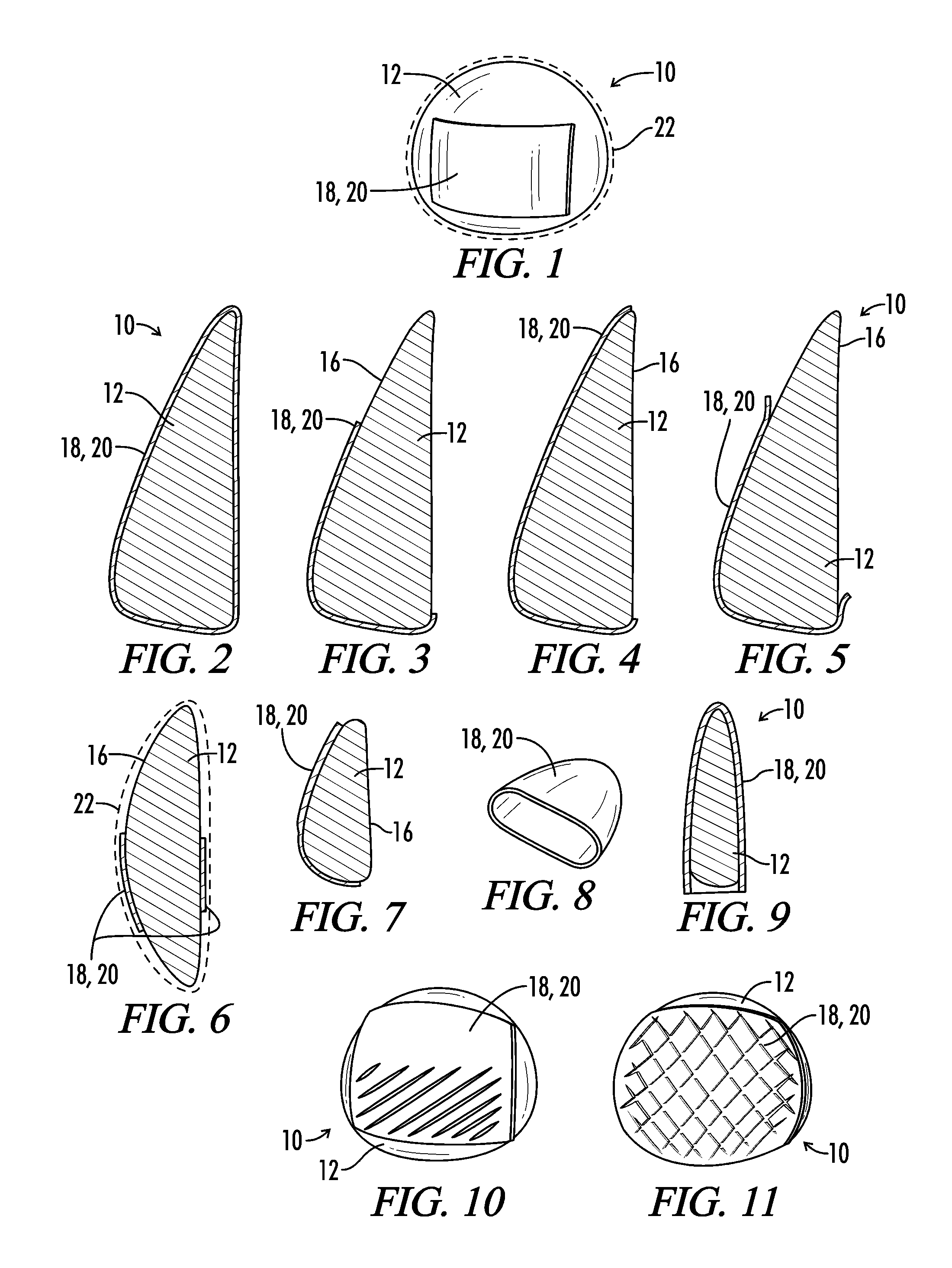 Interfaced Medical Implant Assembly
