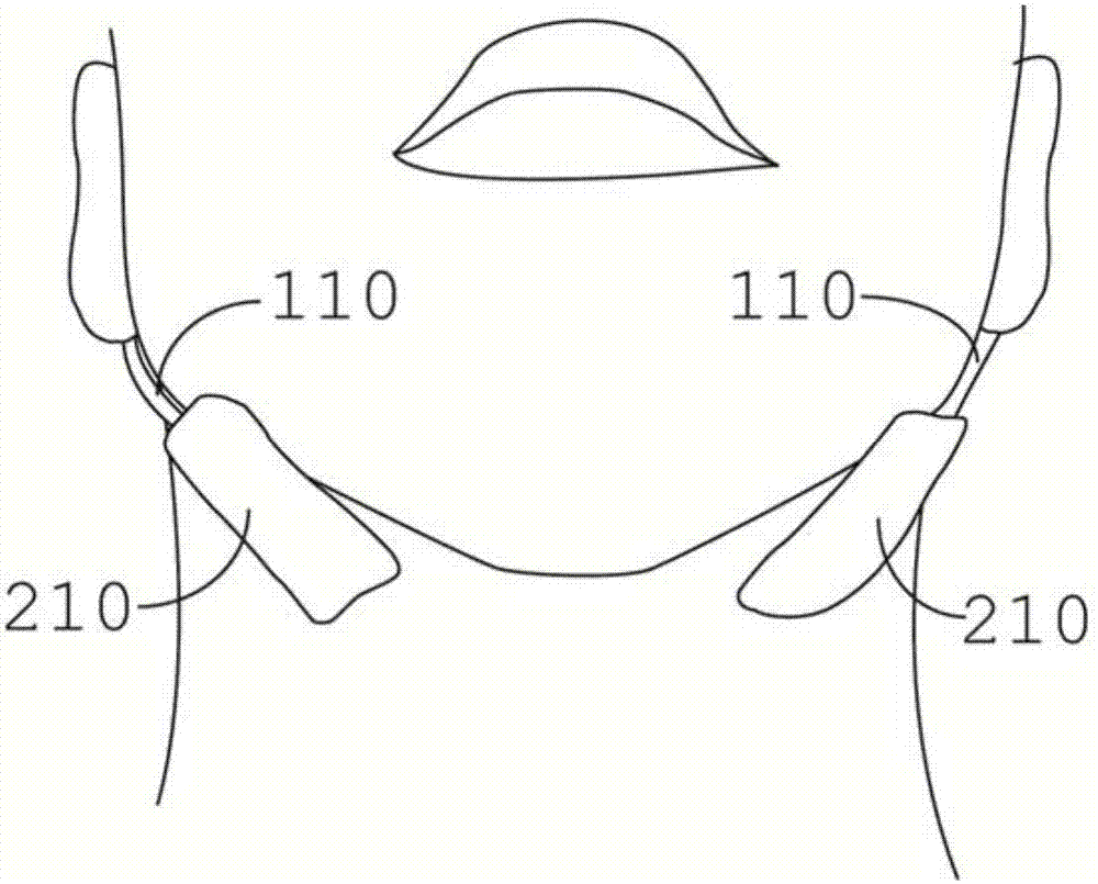 Transcutaneous electrical stimulation snore relieving device