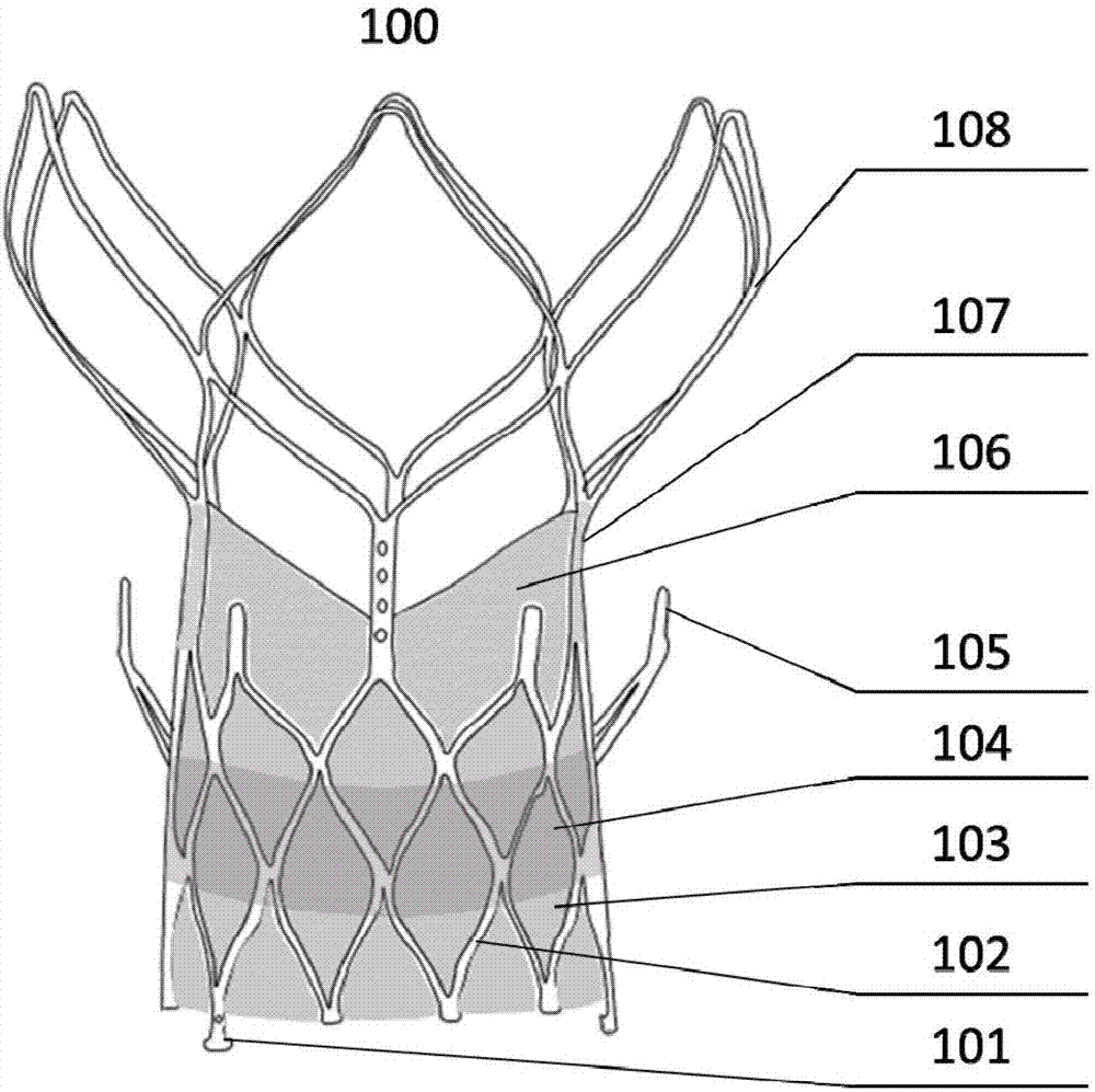 Transcatheter-implanted aortic valve device