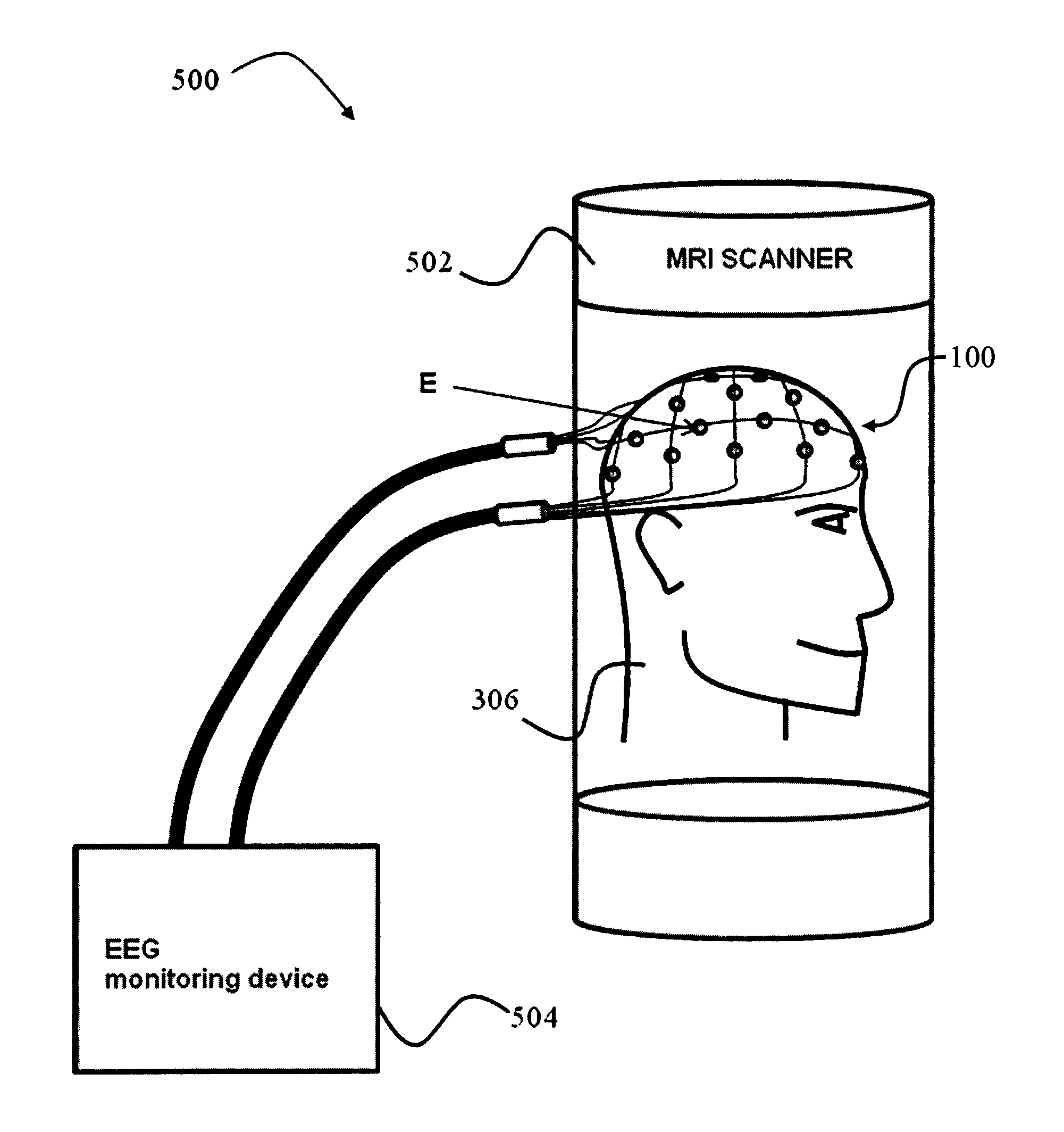 Device for use in electro-biological signal measurement in the presence of a magnetic field