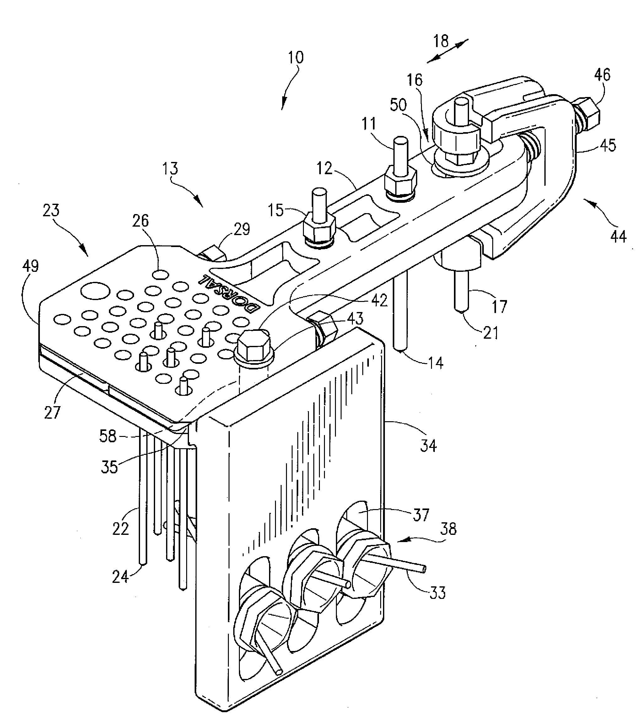 External fixator for distal radius fracture