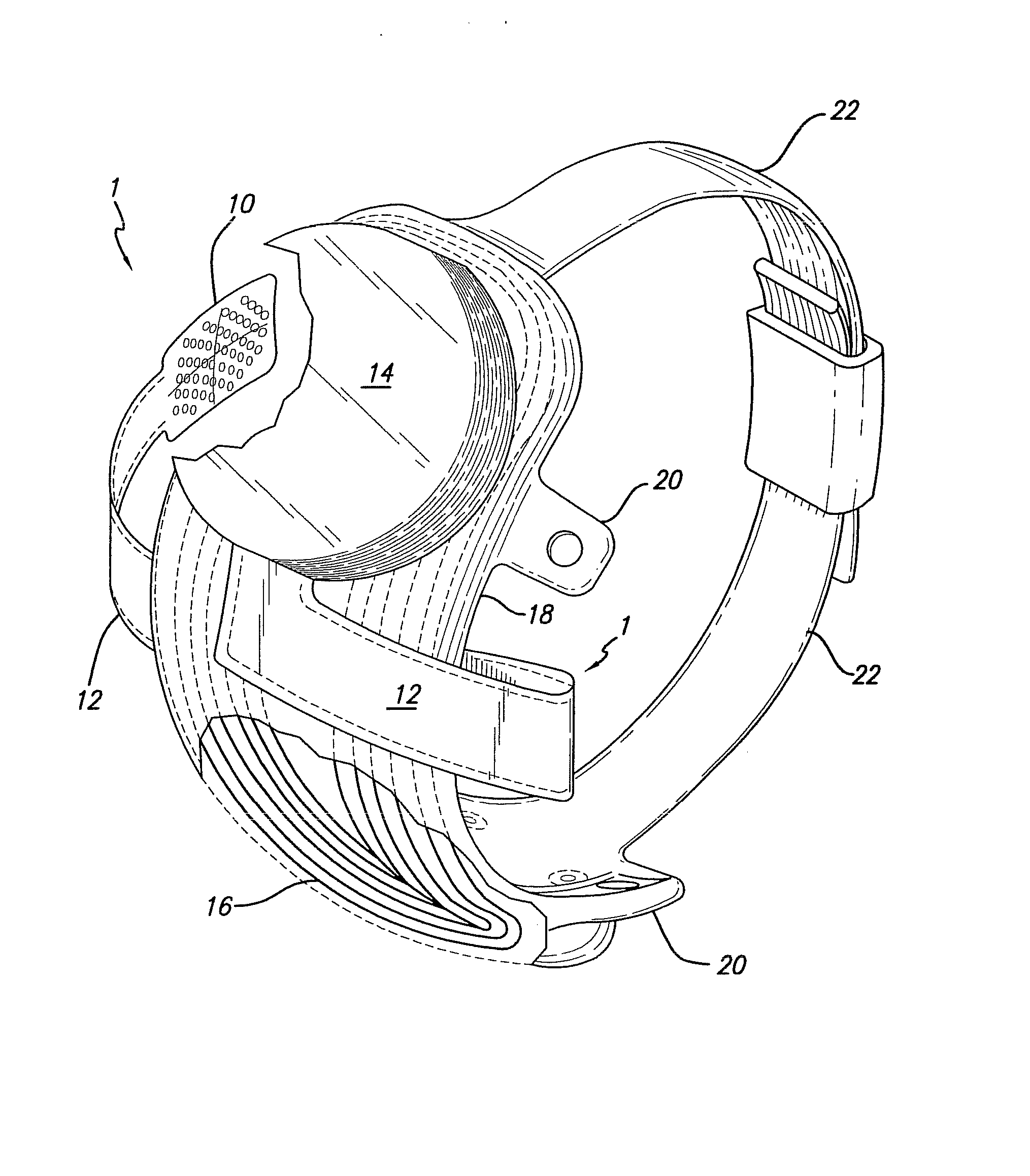 Flexible Circuit Electrode Array with at Least one Tack Opening