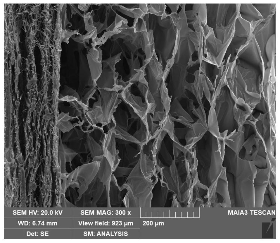 Electrospinning PLGA/PCL fiber membrane composite chitosan sponge stent for oral cavity alveolar bone regeneration and preparation method thereof