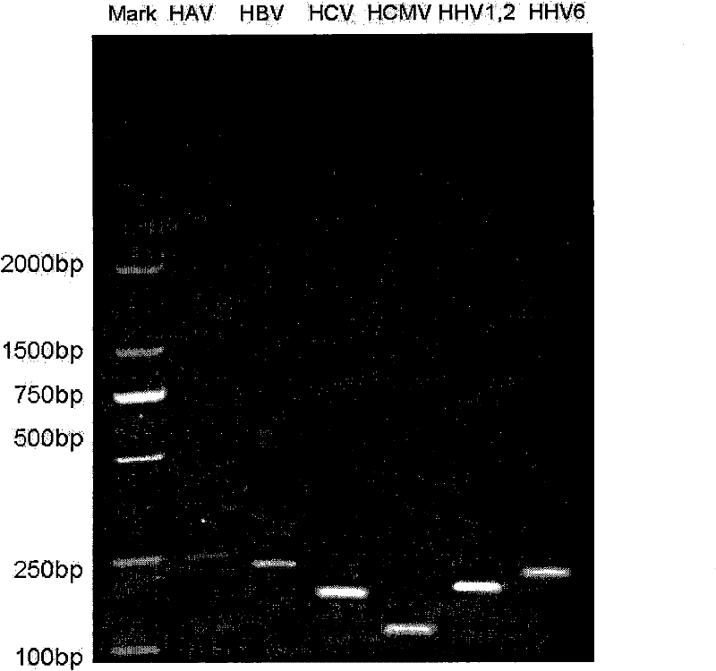 Multiple PCR detection kit for virus hepatitis pathogens and preparation and application thereof