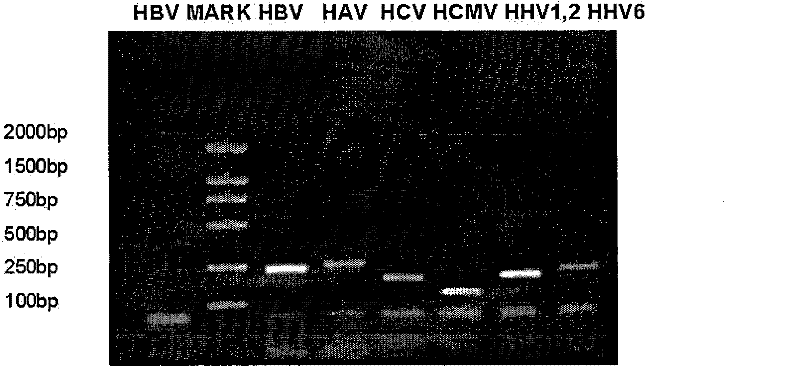 Multiple PCR detection kit for virus hepatitis pathogens and preparation and application thereof