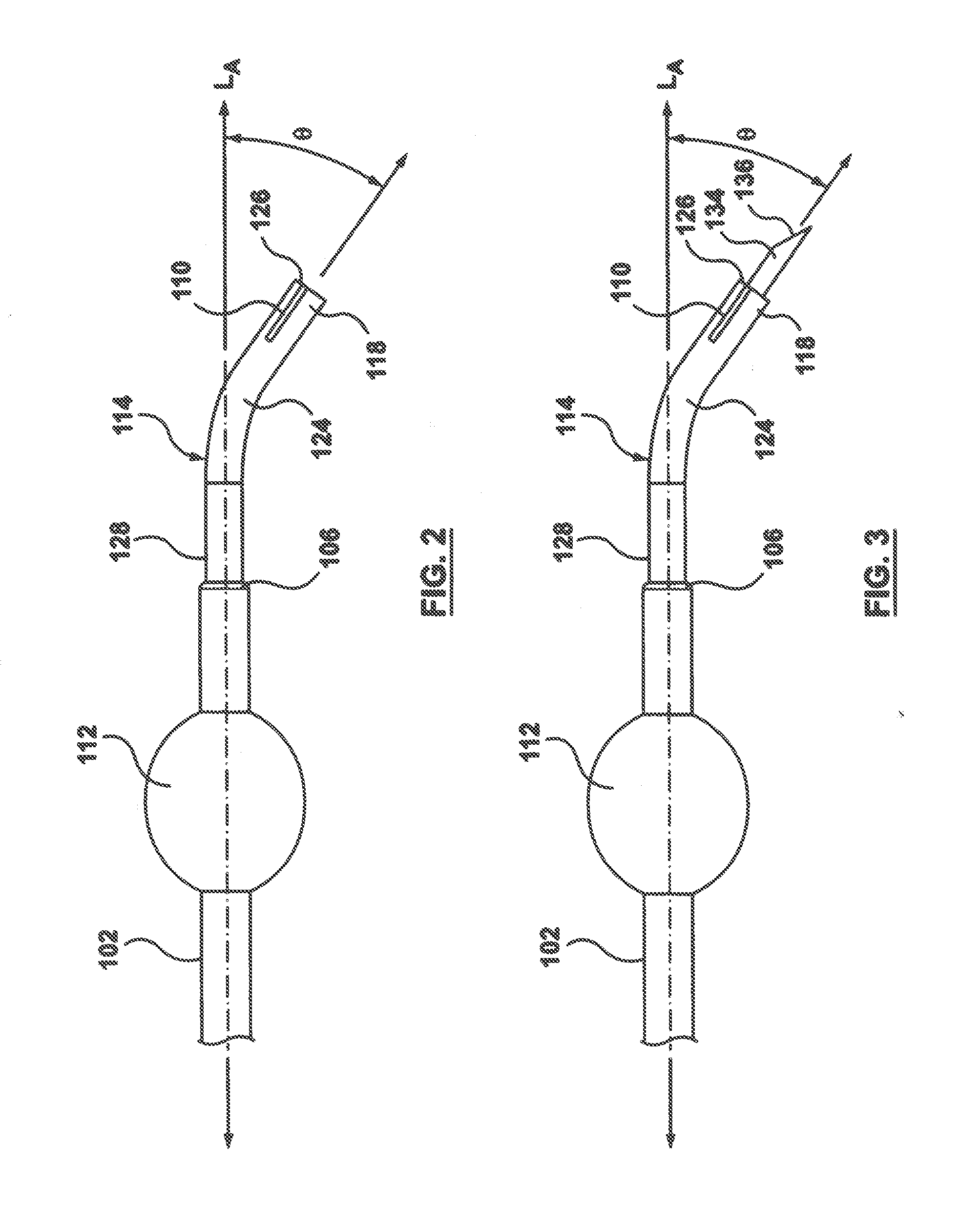 Occlusion Bypassing Apparatuses and Methods for Bypassing an Occlusion in a Blood Vessel