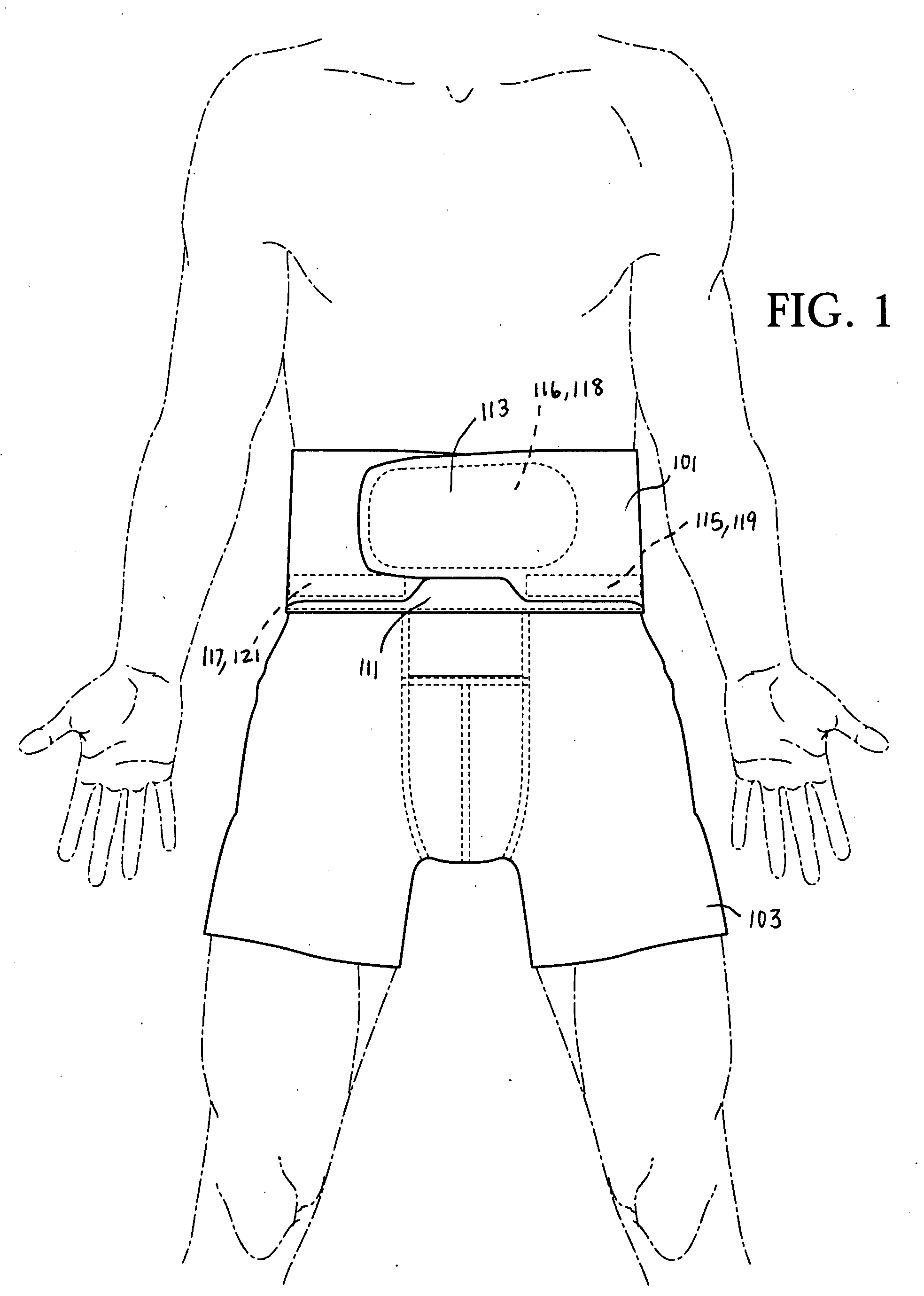 Back support garment apparatus