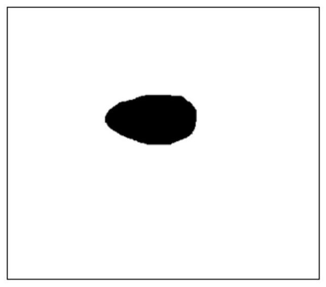 Thyroid nodule real-time segmentation method based on full convolution dense hole network