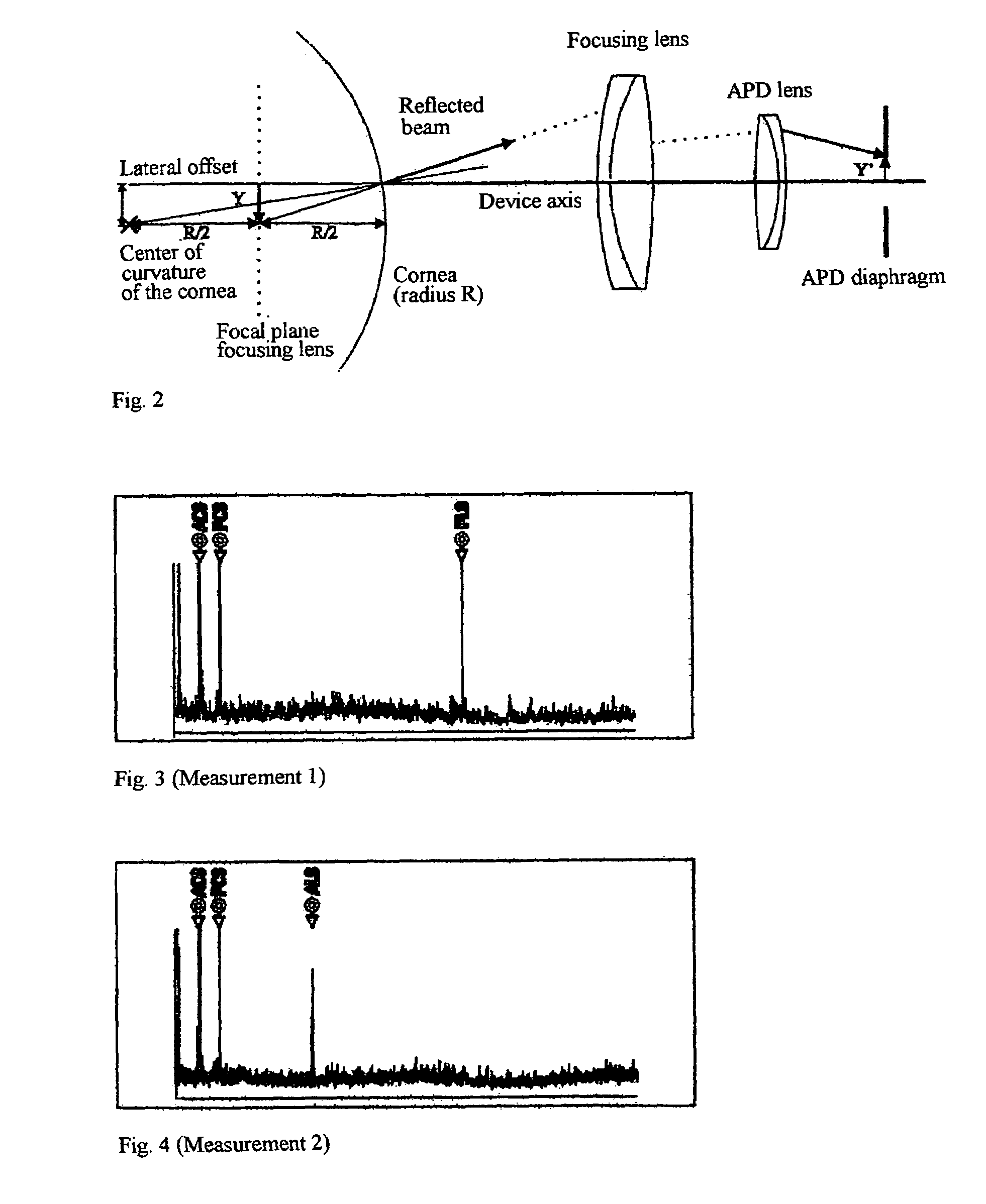 Method and arrangement for the measurement of the anterior segment of the eye