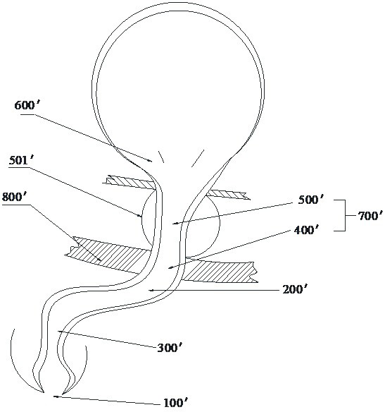 Artificial urethra and artificial urethra implantation kit