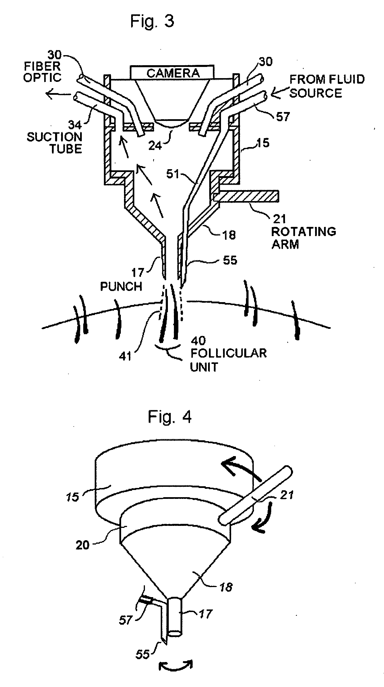 Hair harvesting device and method with localized subsurface dermal fluid insertion