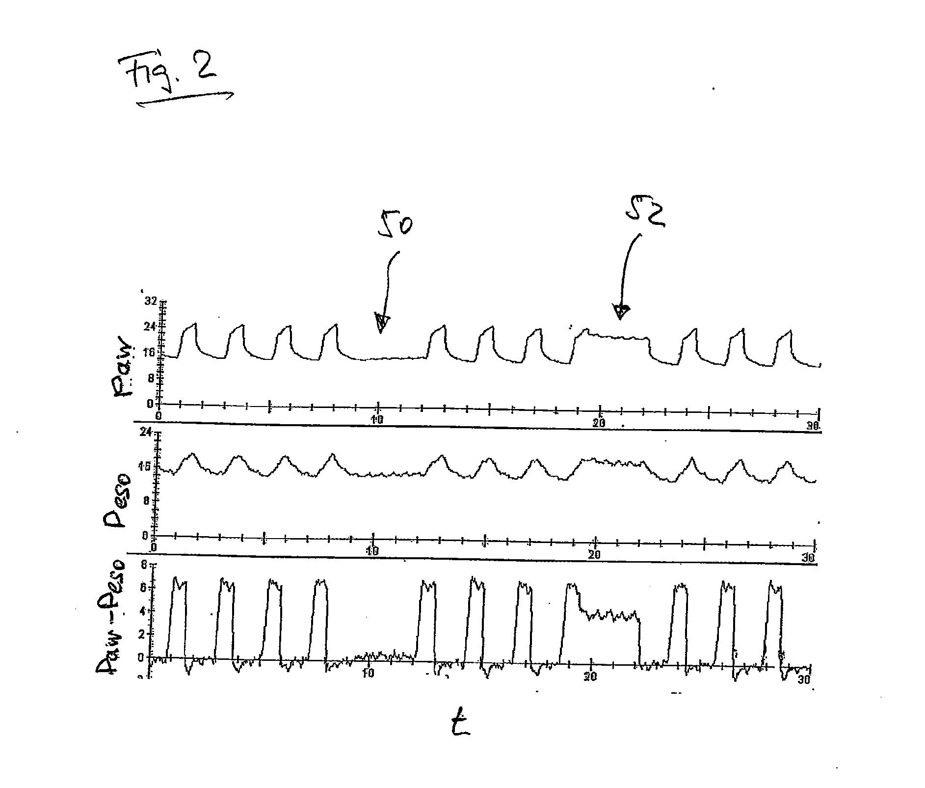 System for automated adjustment of a pressure set by a ventilation device