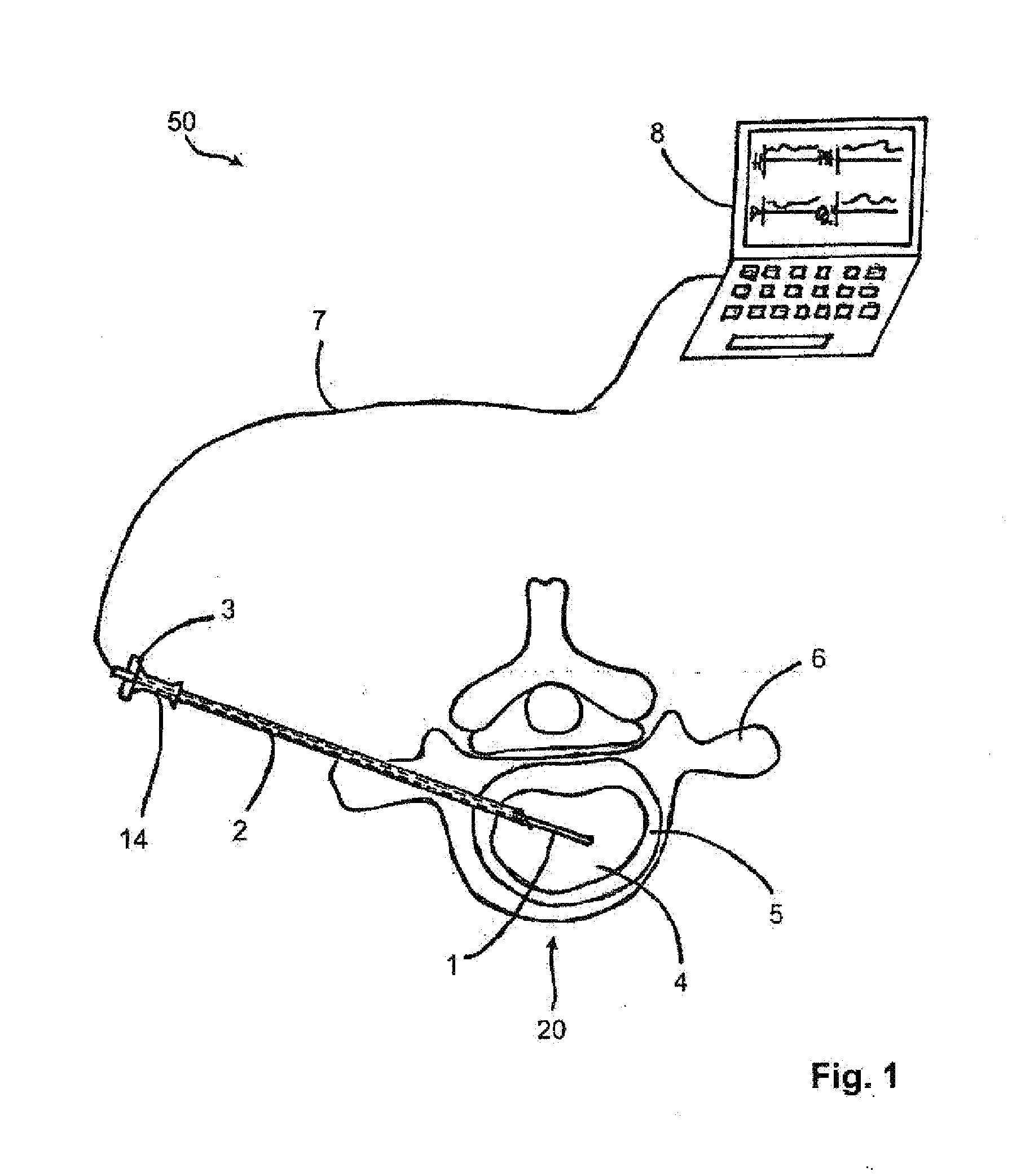 Intervertebral disc analysis system and method