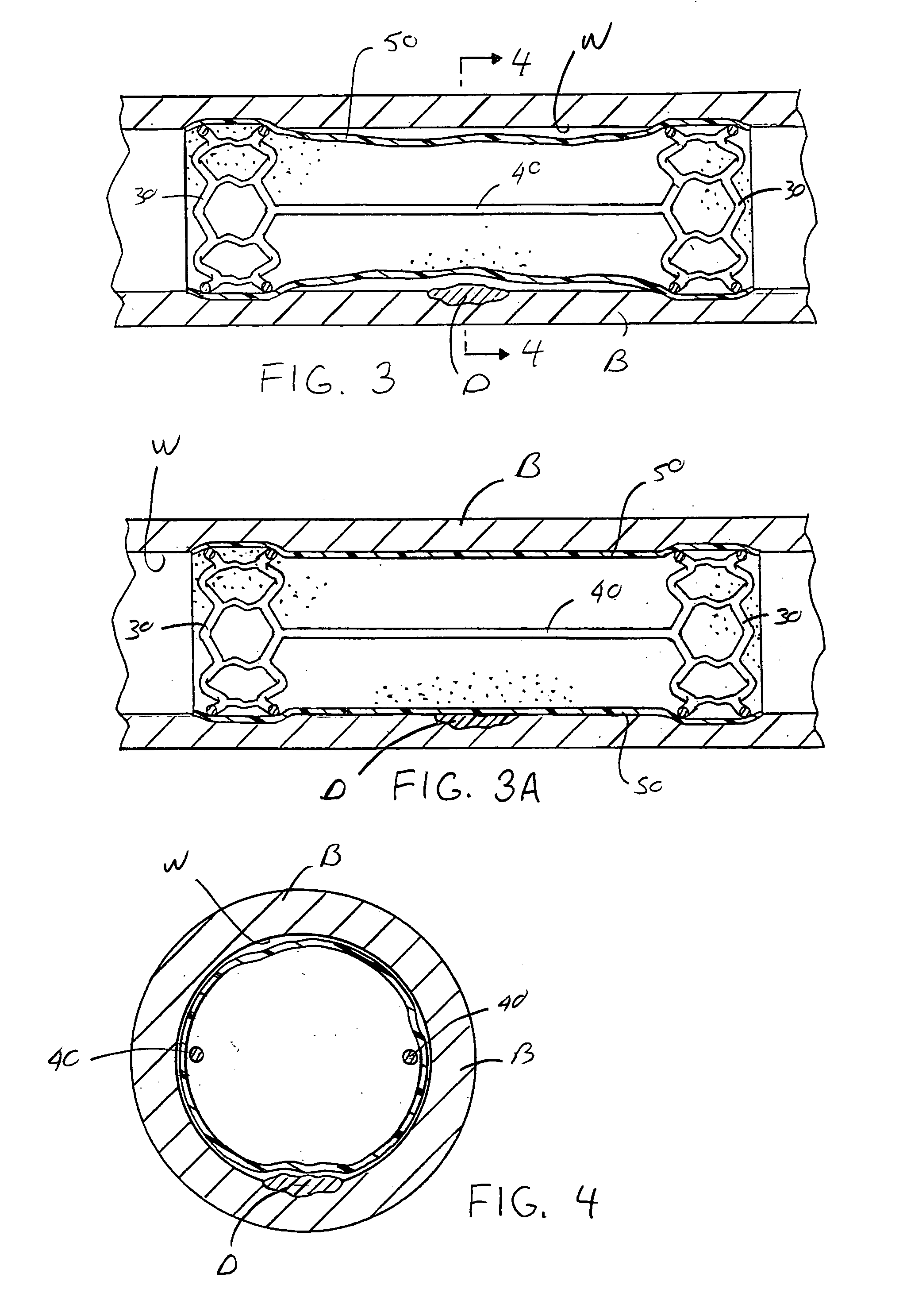 Vascular protective device