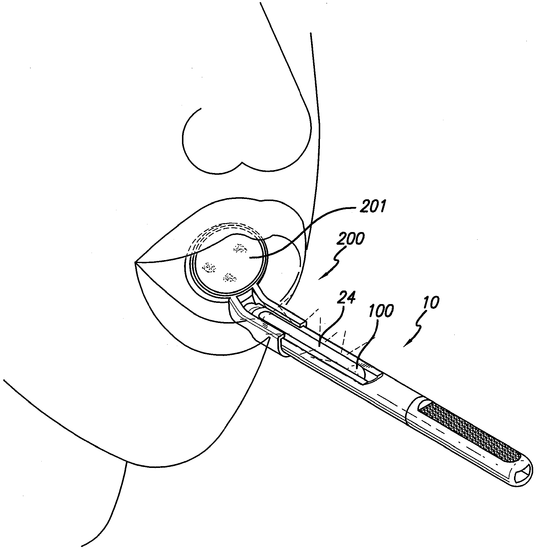 Device for oral cavity examination