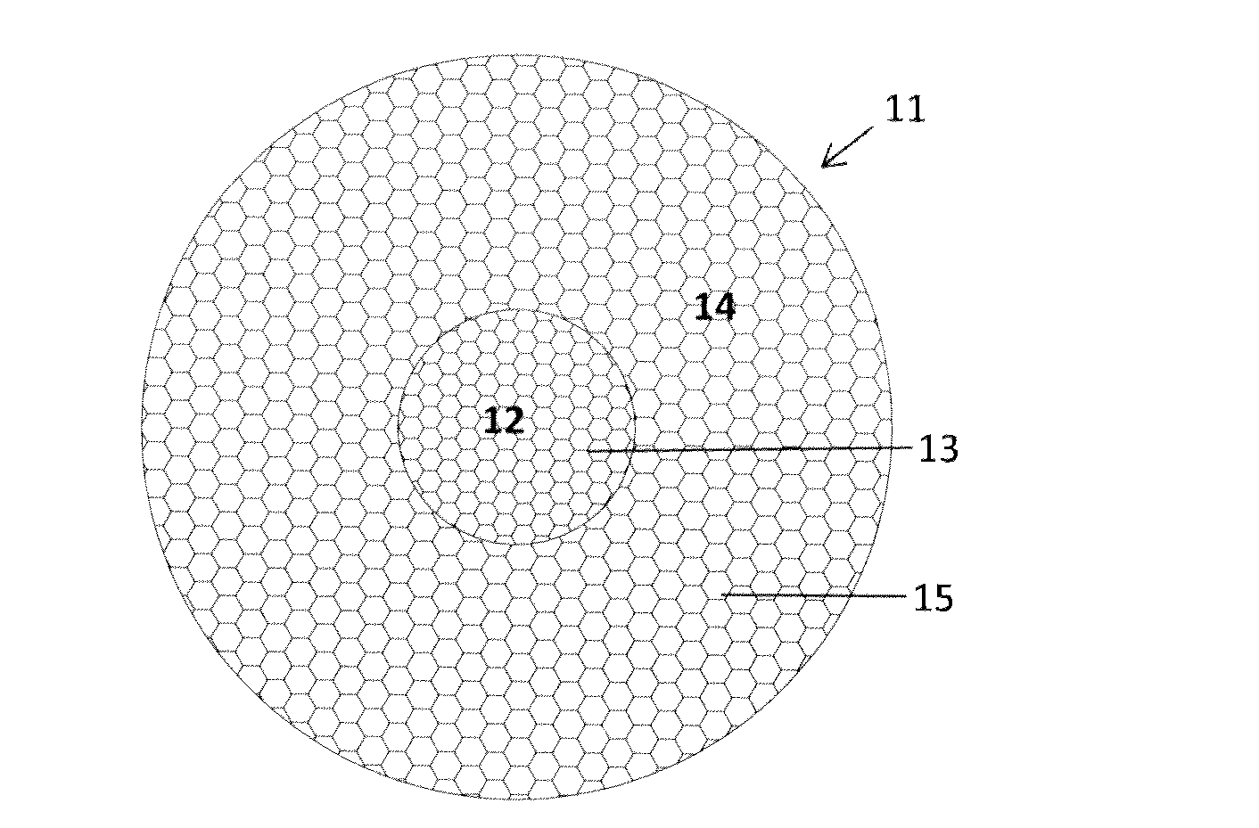 Resorbable medical mesh implant for repair or prevention of parastomal hernia