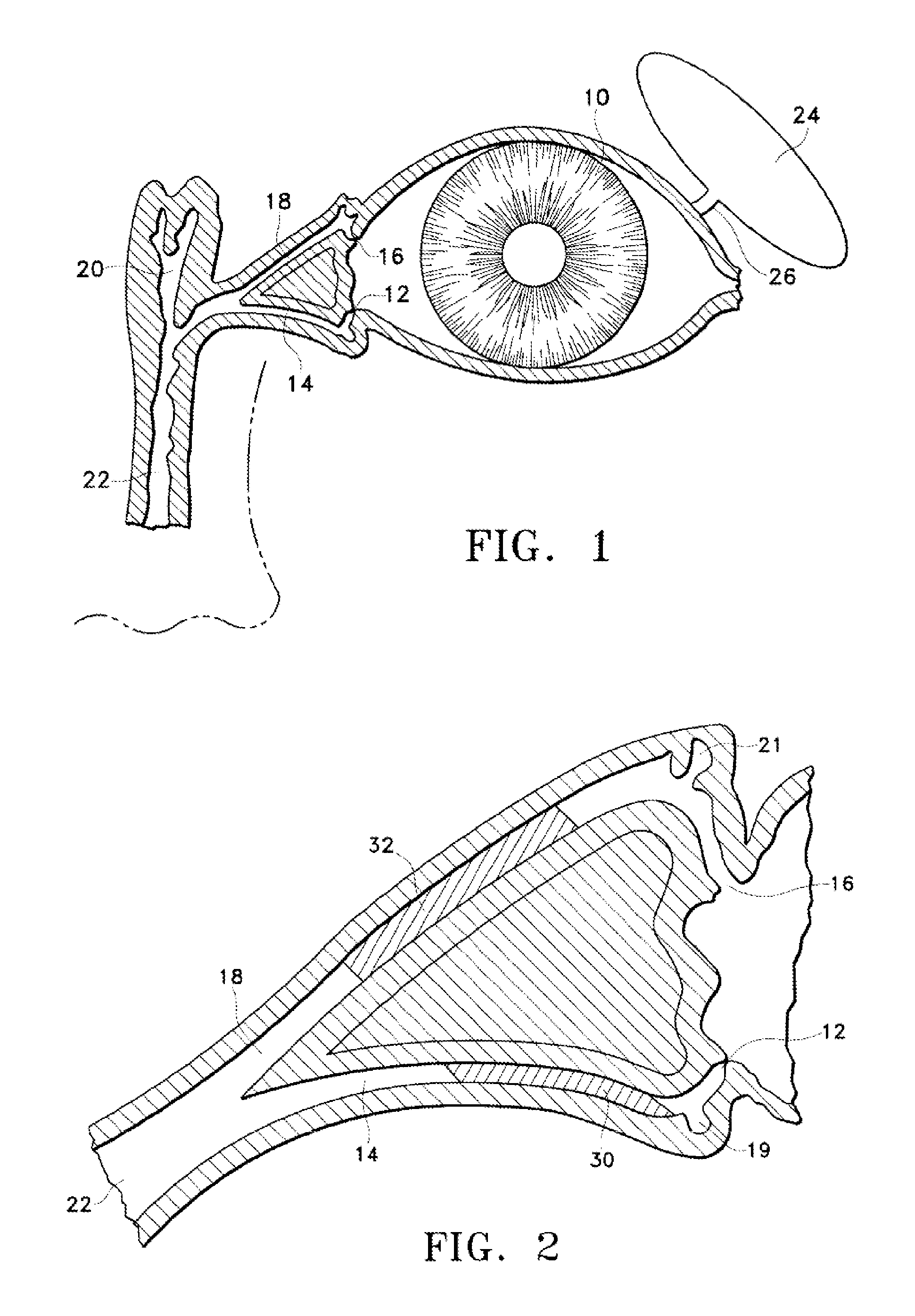 Punctal plug comprising a water-insoluble polymeric matrix