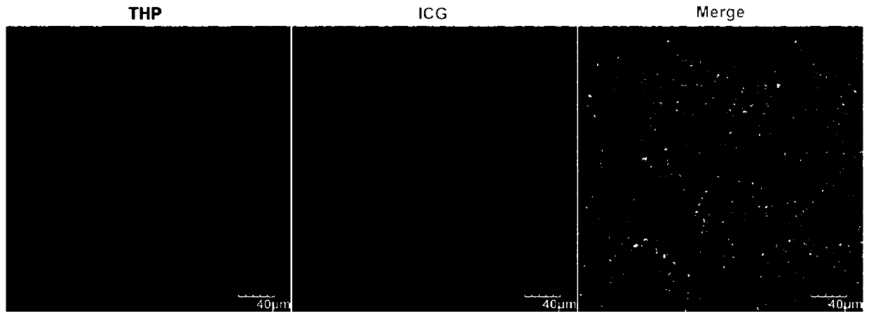 Human polypeptide for constructing tumor pH response micro-robot and application thereof